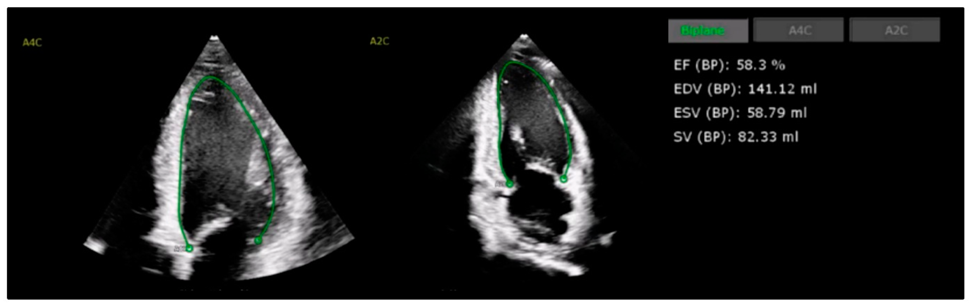 Cancers 17 00605 g002