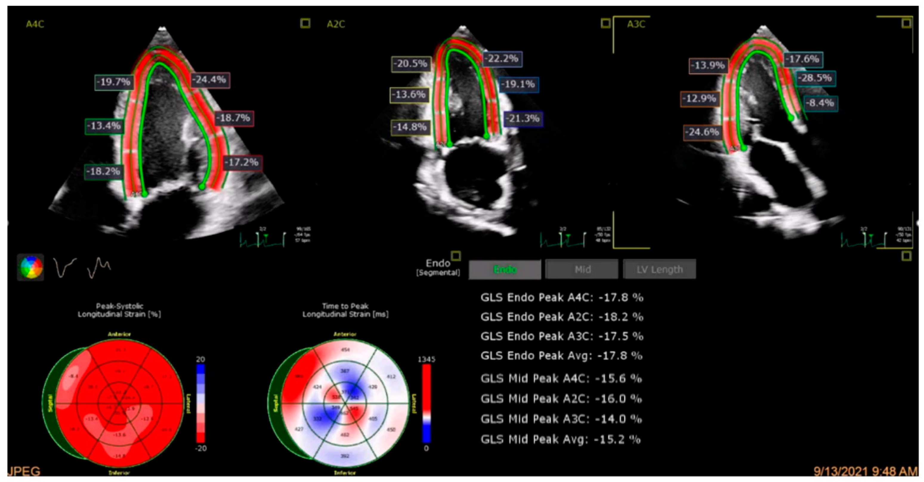 Cancers 17 00605 g003