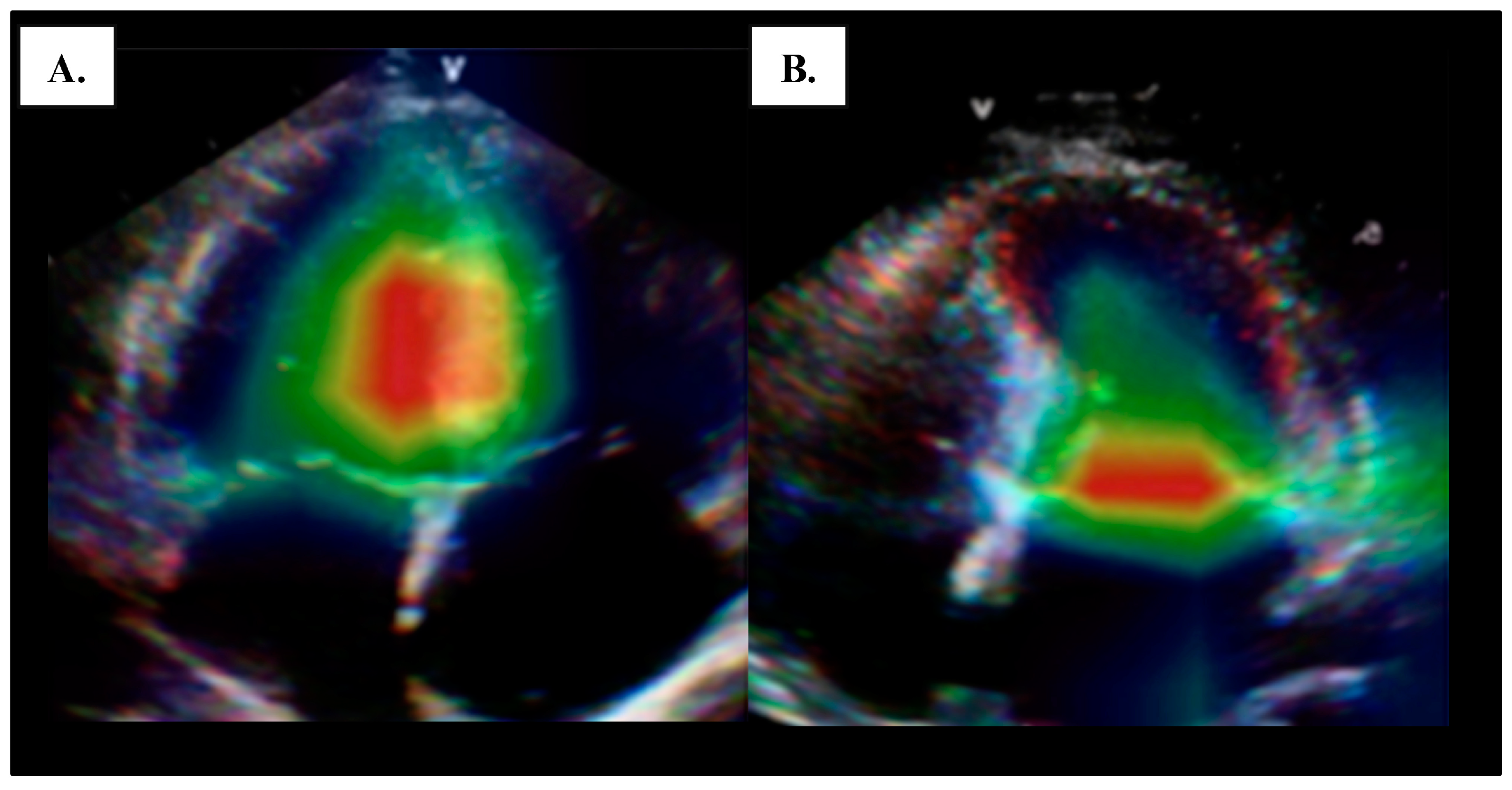 Cancers 17 00605 g004