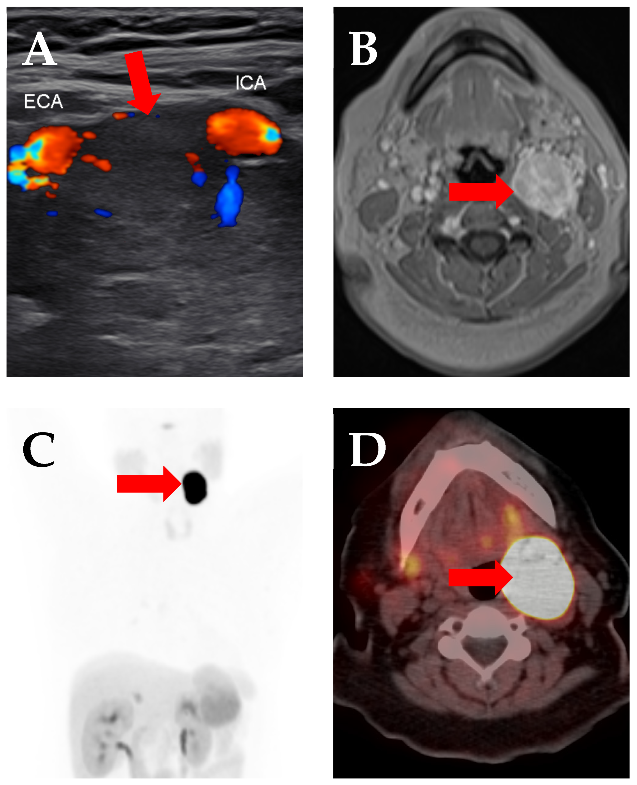 Cancers 17 00695 g001