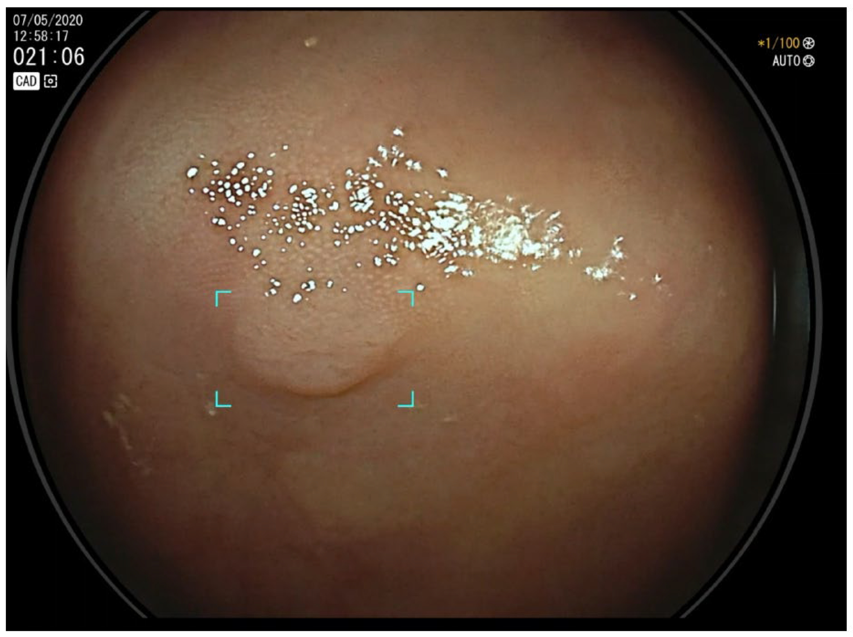 Cancers 17 00797 g001