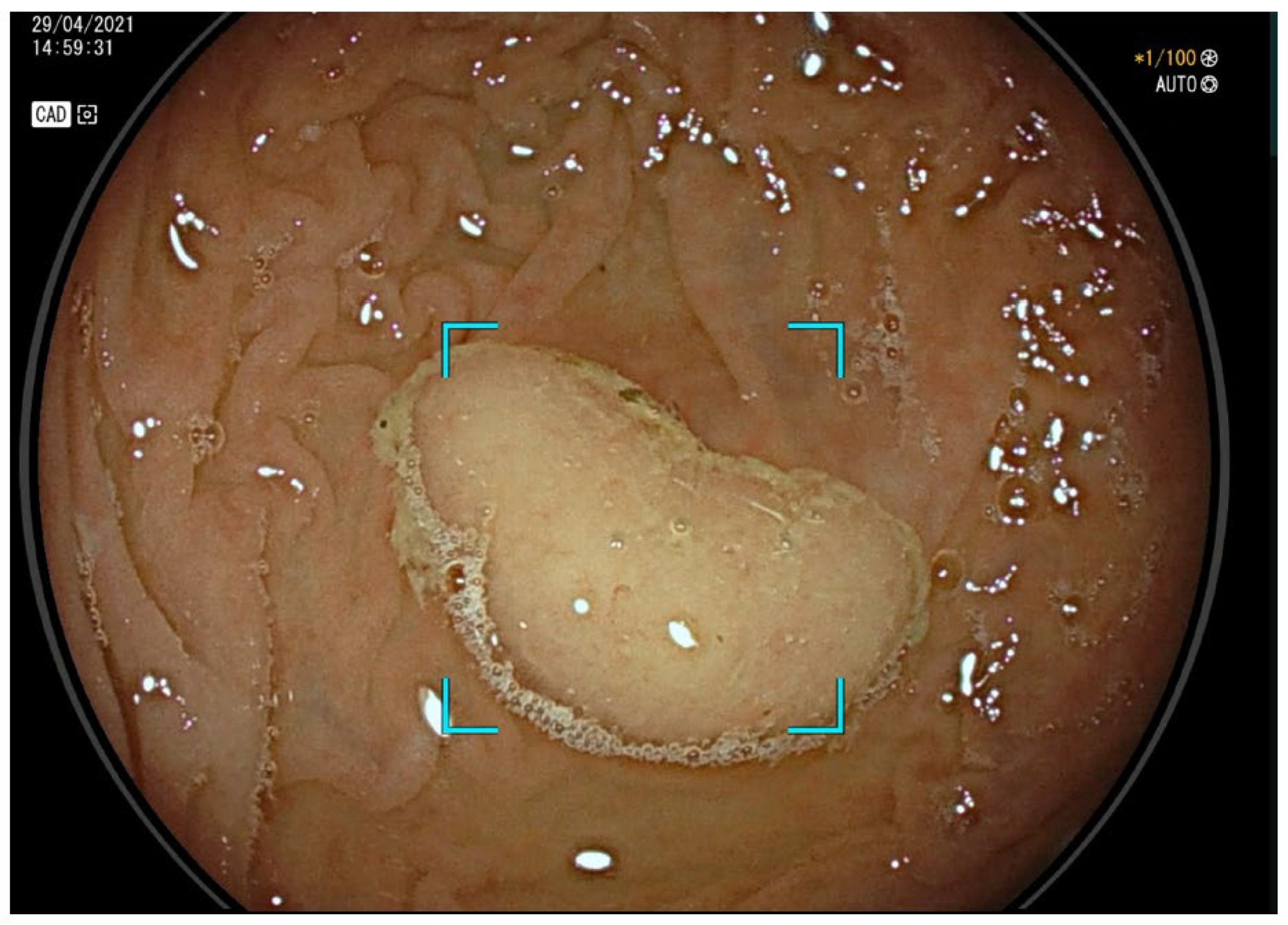 Cancers 17 00797 g002