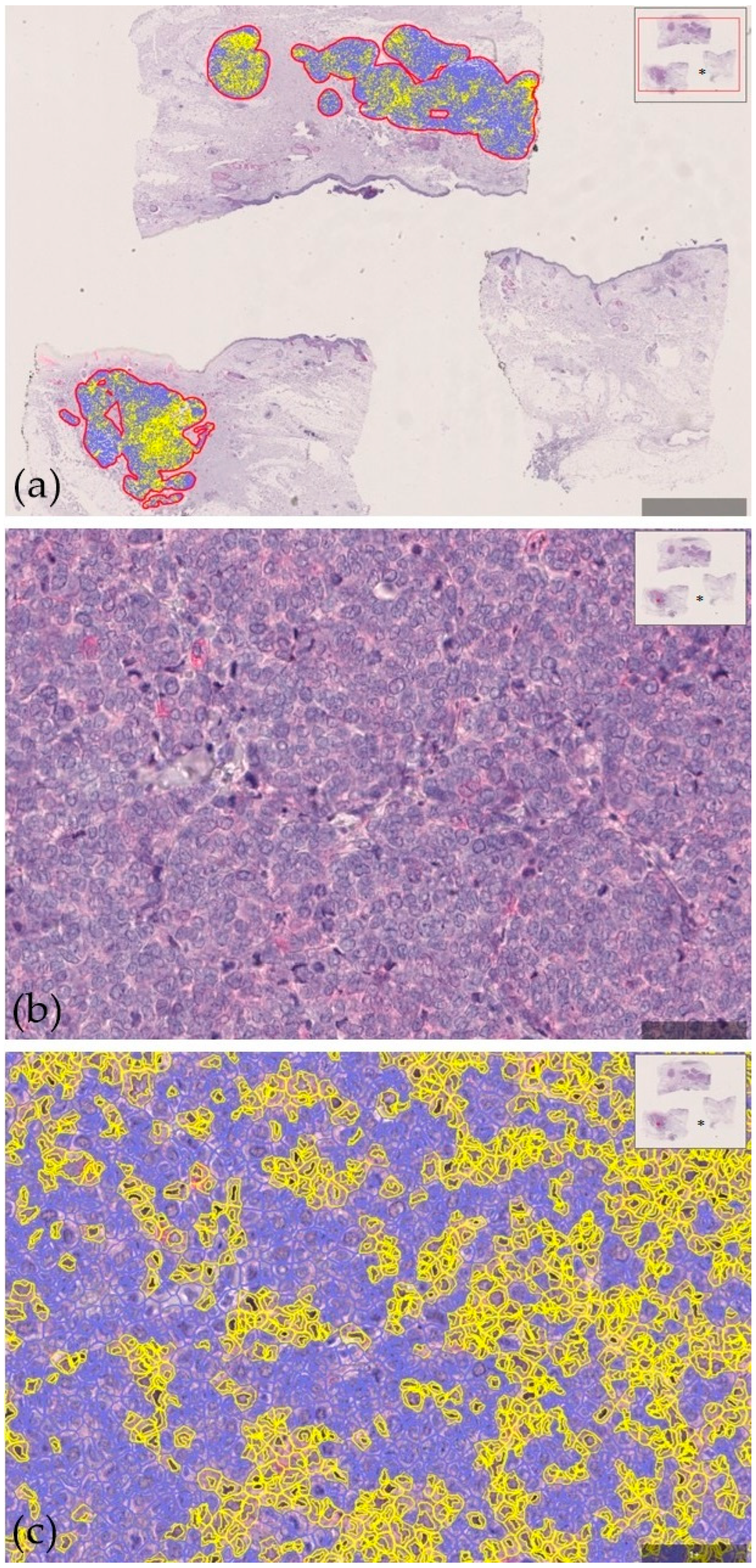 Cancers 17 00822 g001