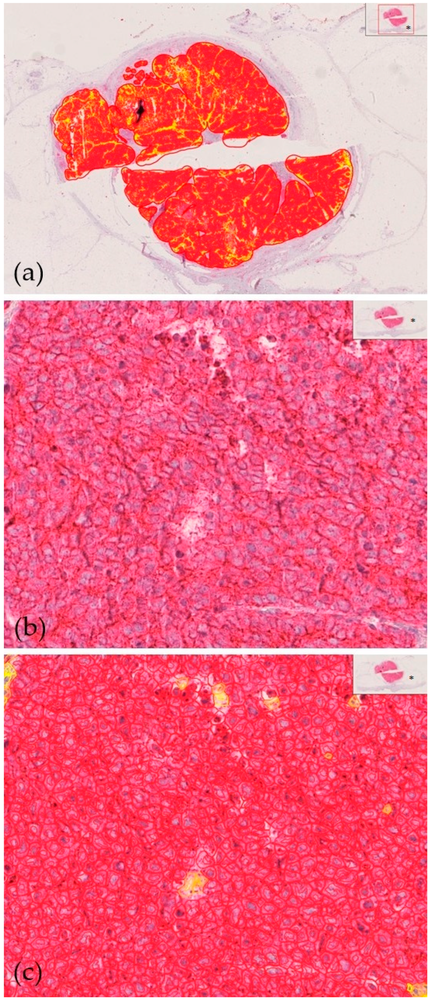 Cancers 17 00822 g002