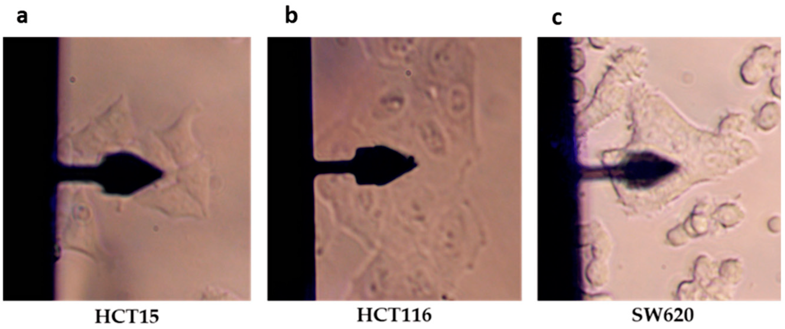 Cancers 17 00858 g005