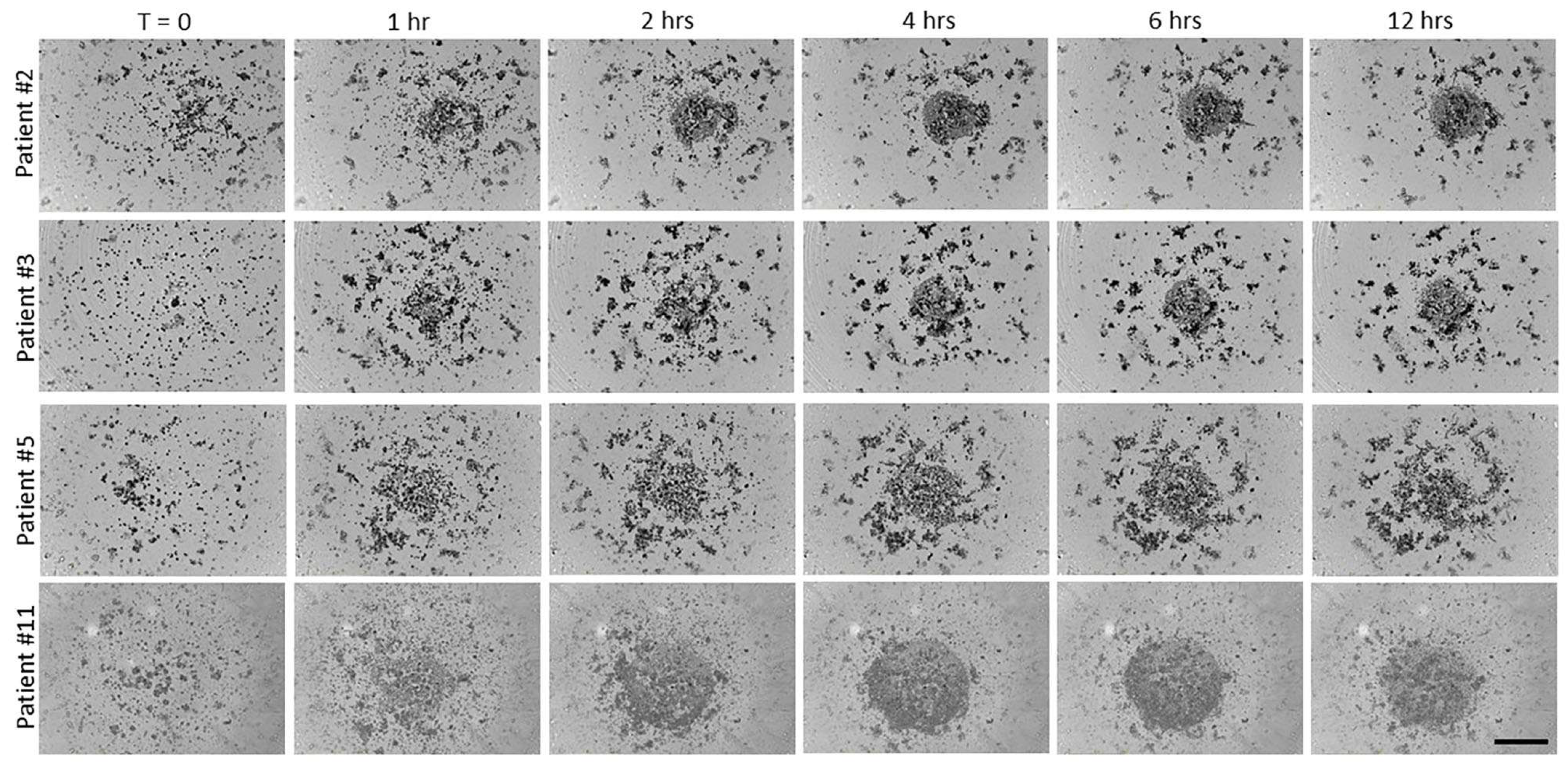 Cancers 17 00901 g005 Cancers 17 00901 g005