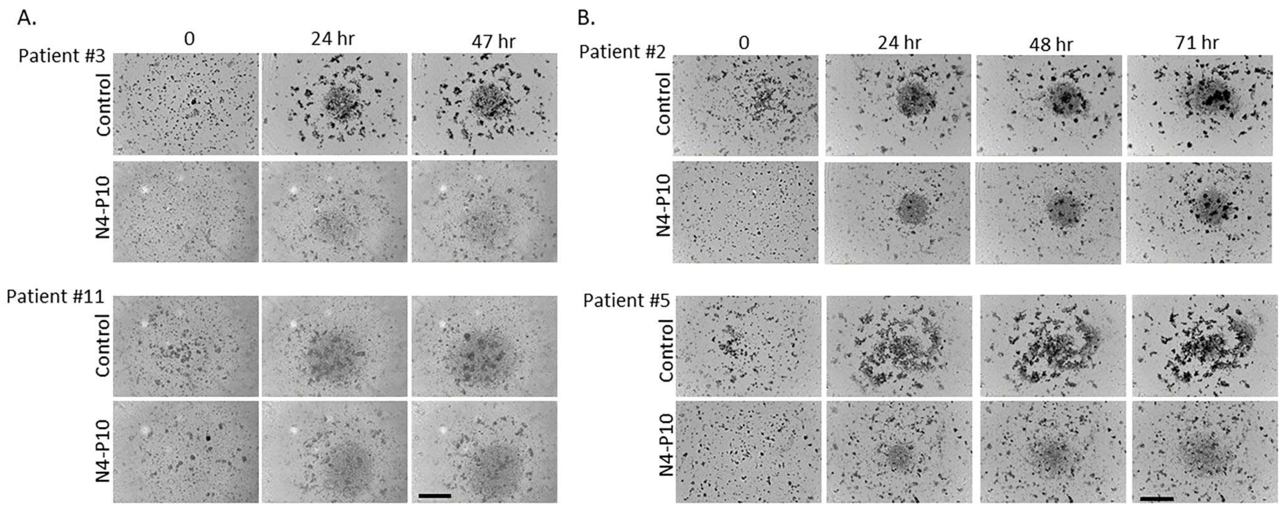 Cancers 17 00901 g006 Cancers 17 00901 g006