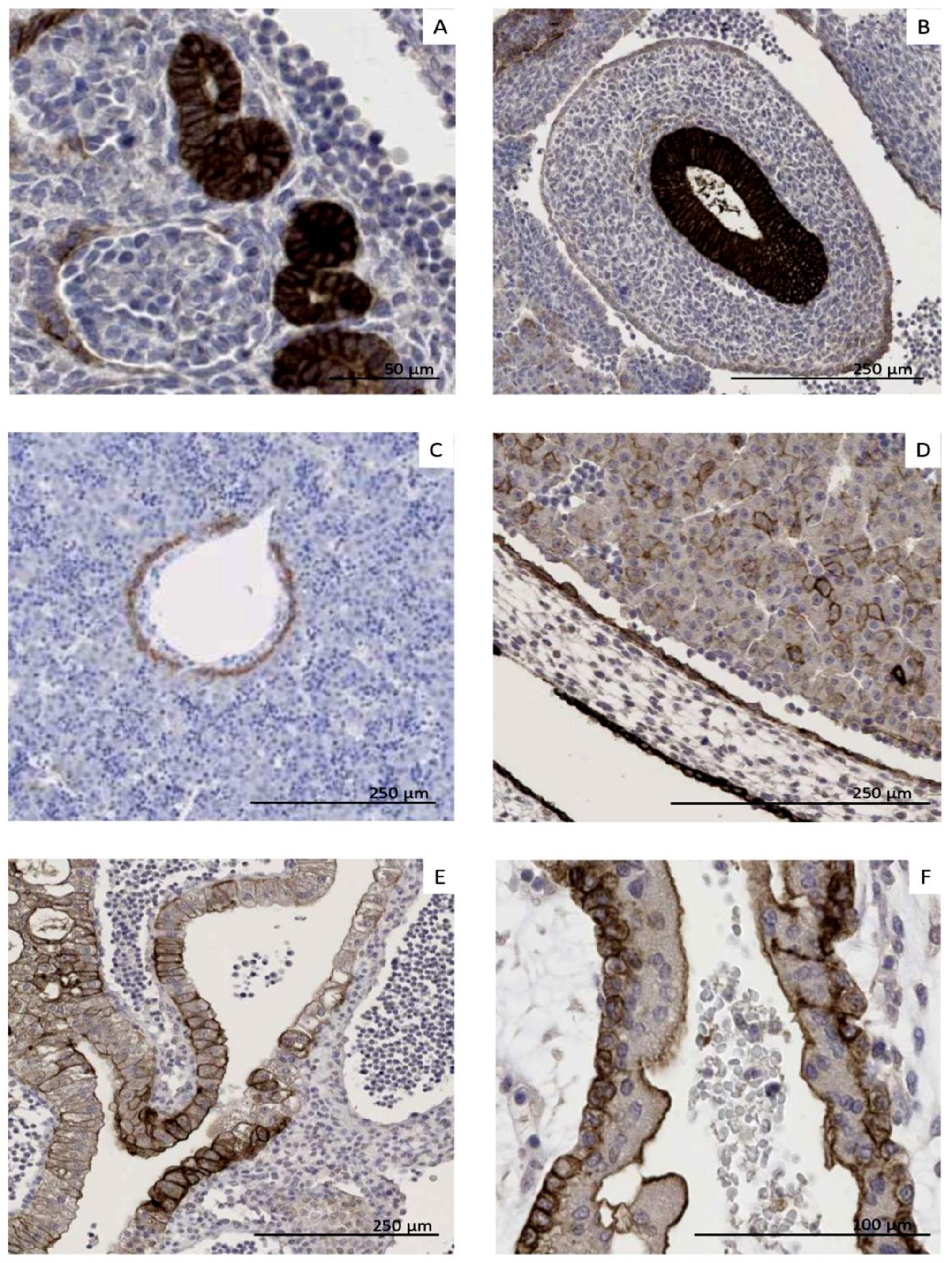 Cancers 17 00920 g003