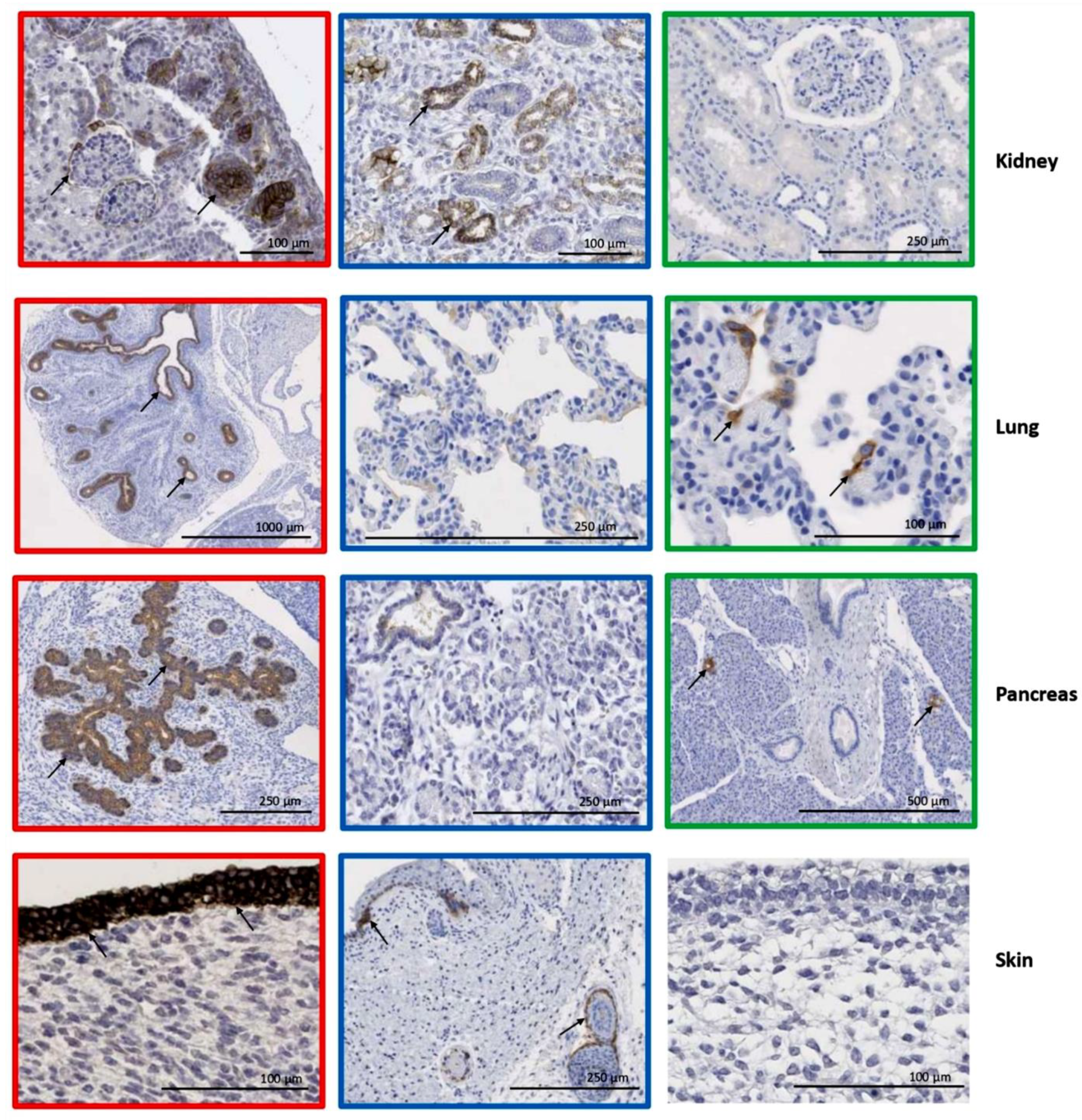 Cancers 17 00920 g004