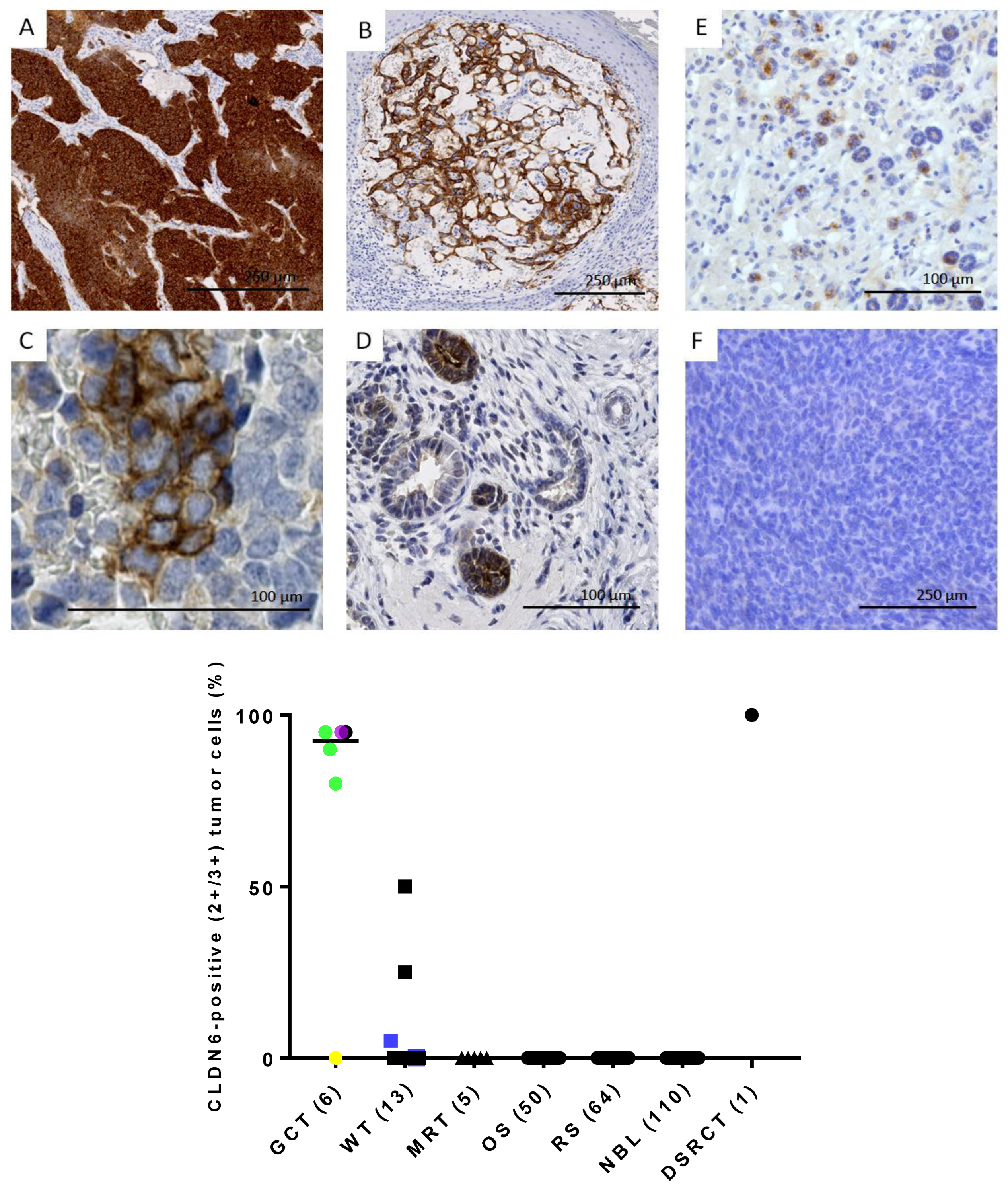 Cancers 17 00920 g005