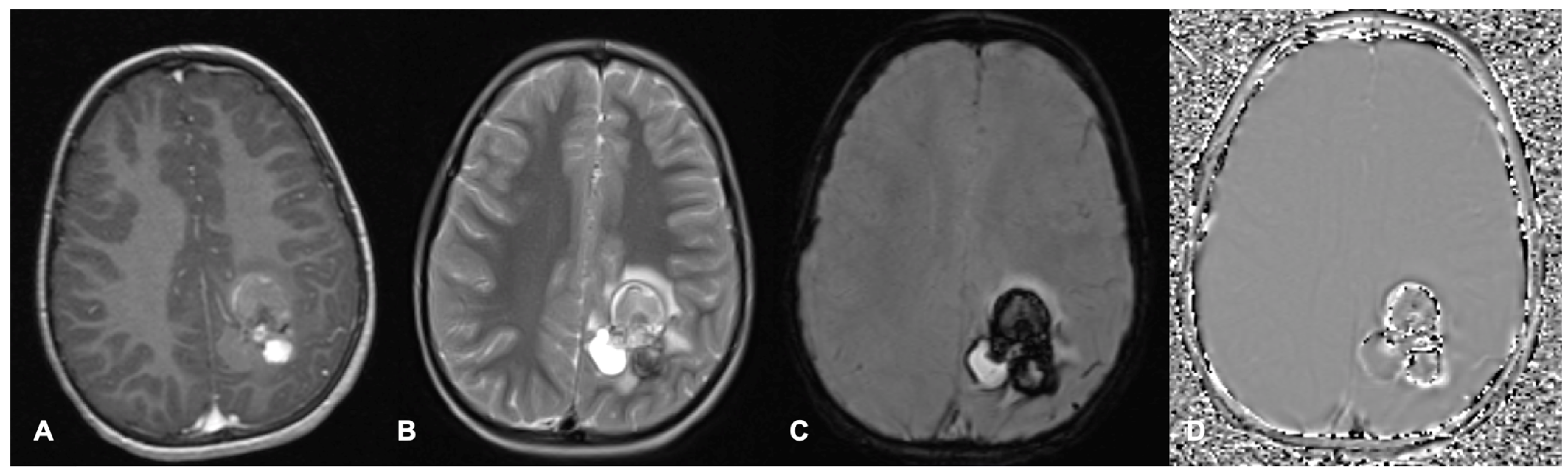 Cancers 17 00947 g002 Cancers 17 00947 g002