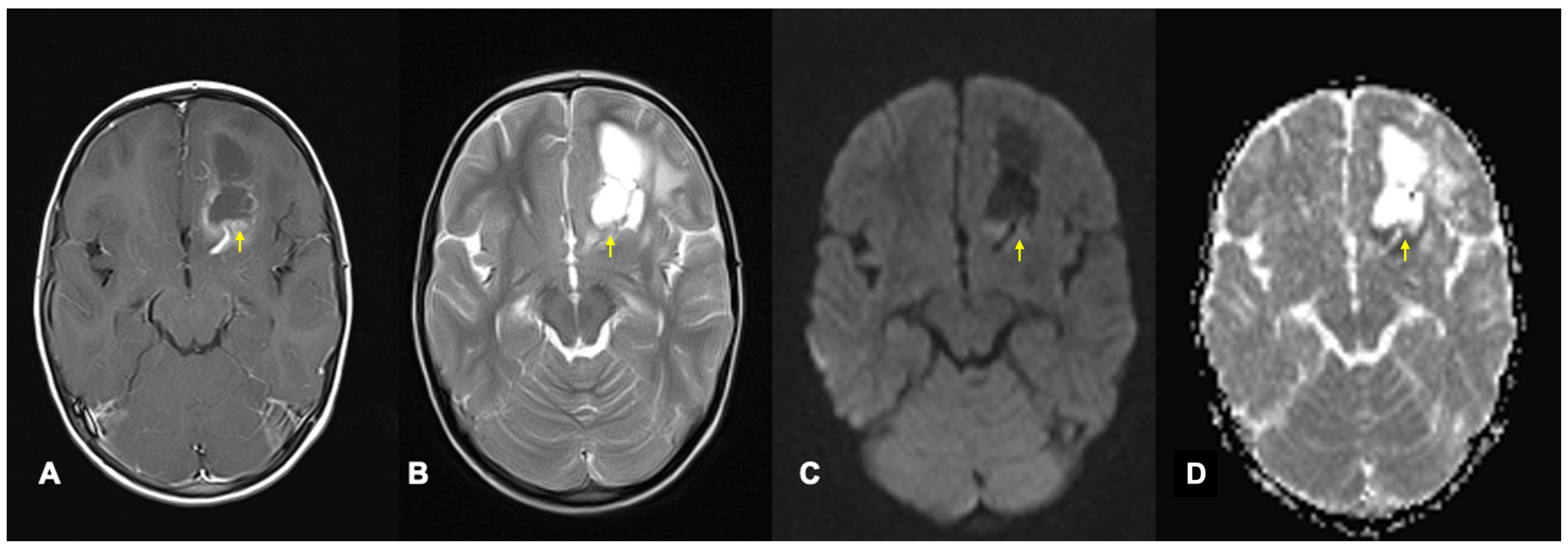 Cancers 17 00947 g003 Cancers 17 00947 g003