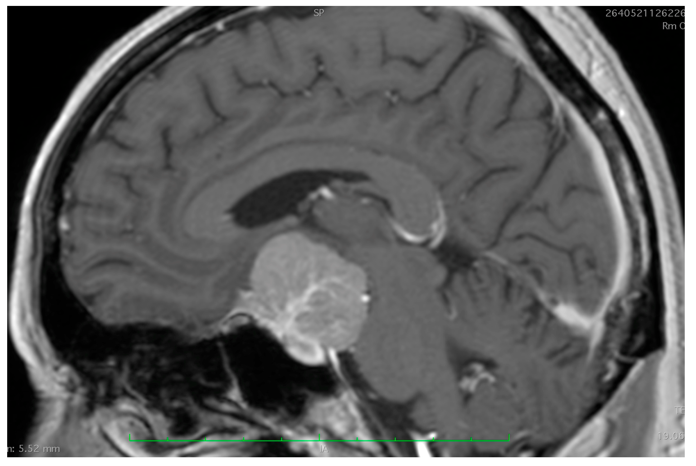 Cancers 17 00987 g002