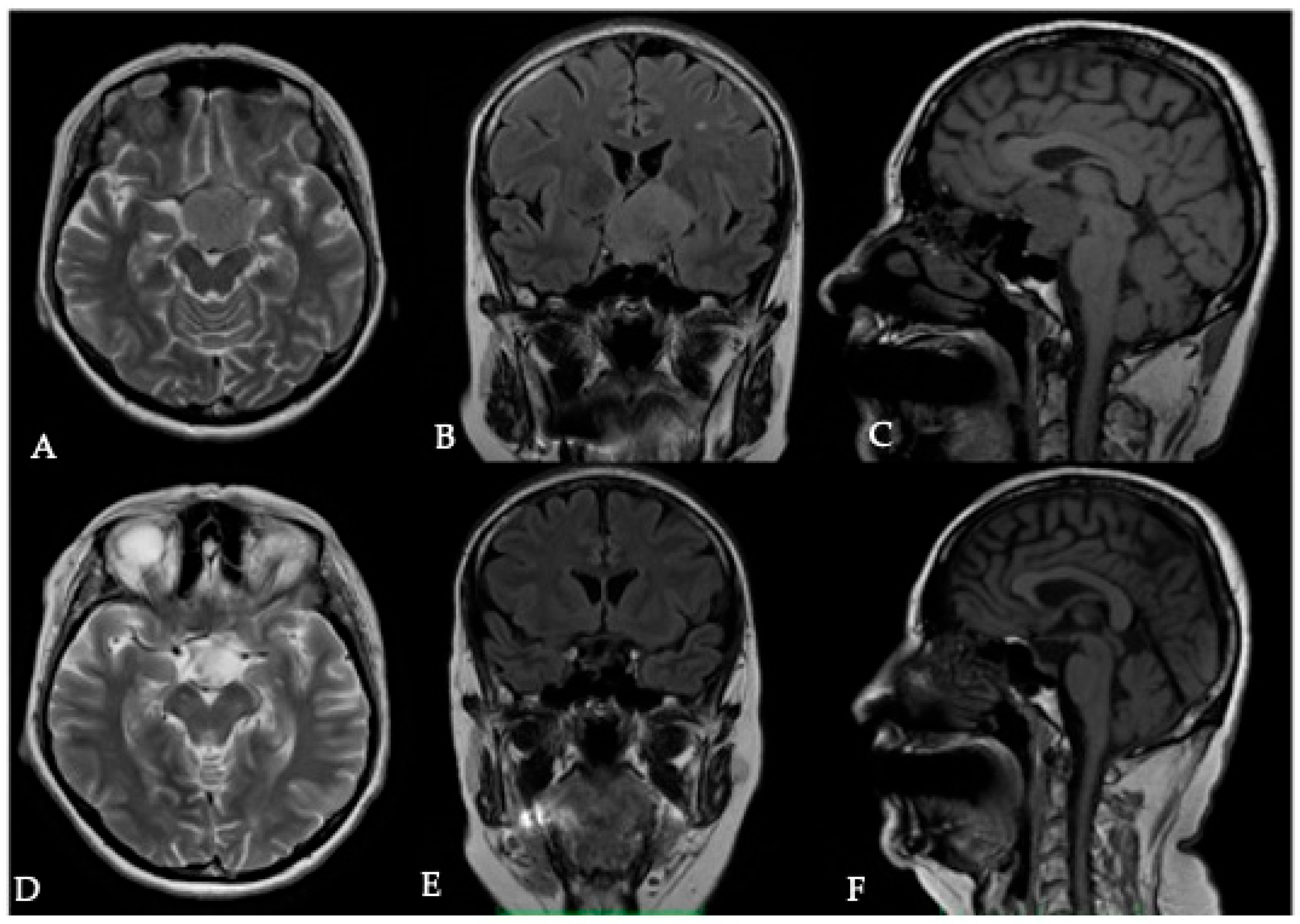 Cancers 17 00987 g004