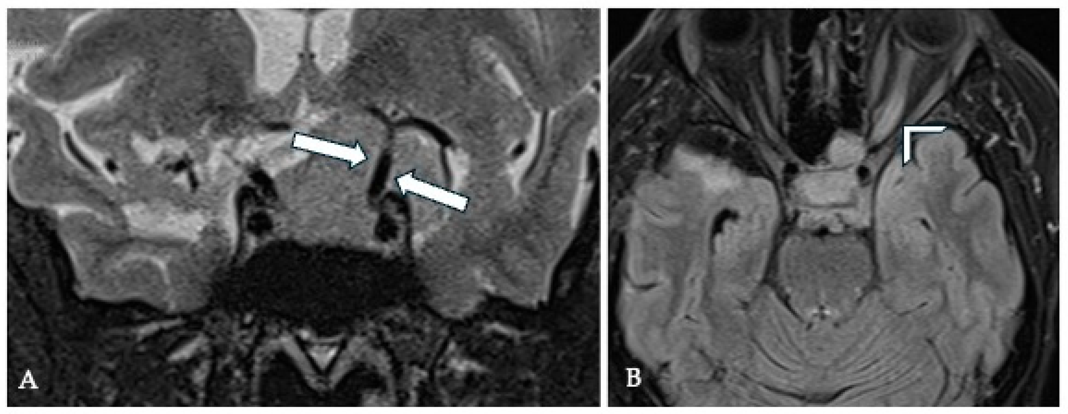 Cancers 17 00987 g005