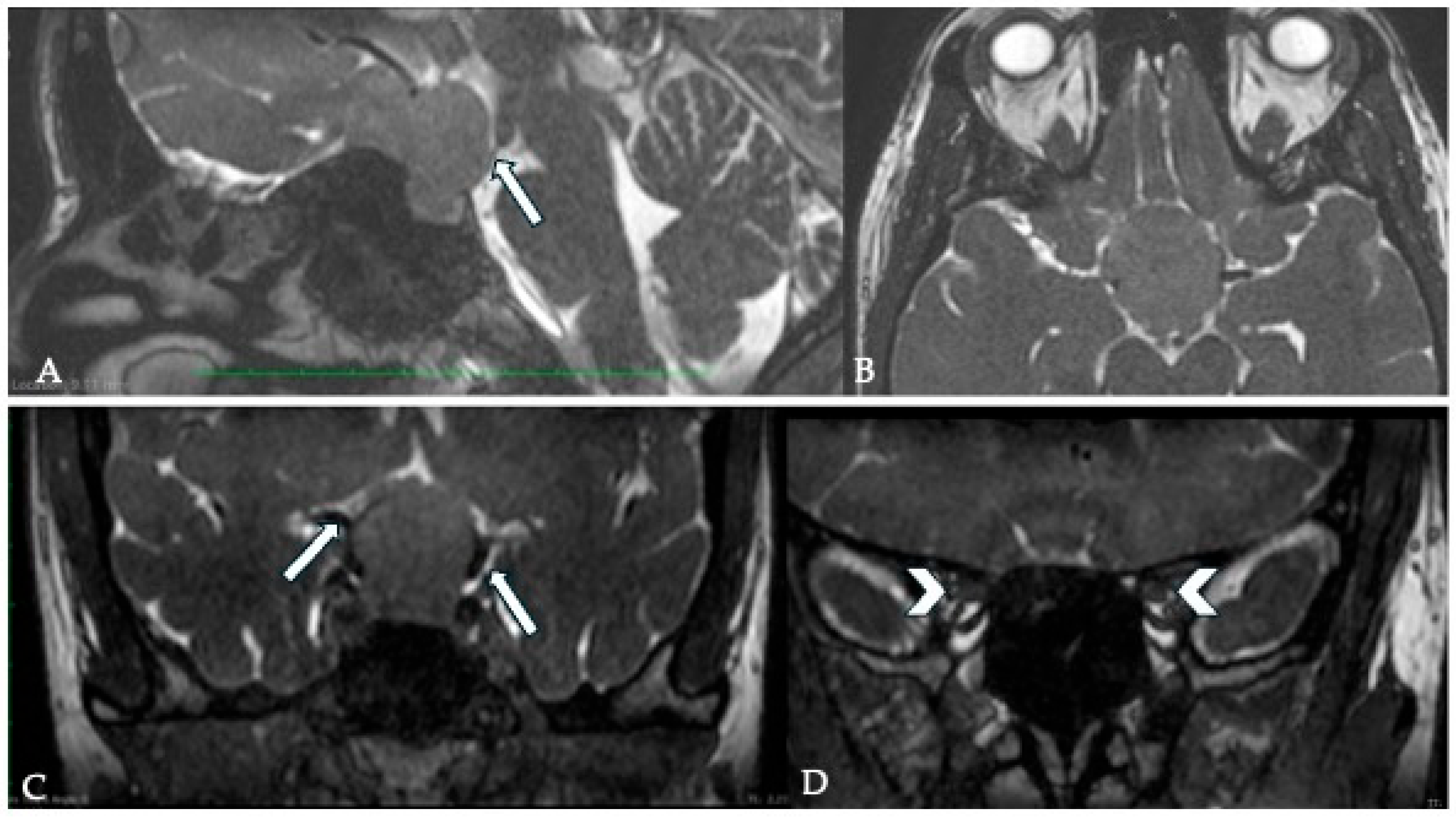 Cancers 17 00987 g006