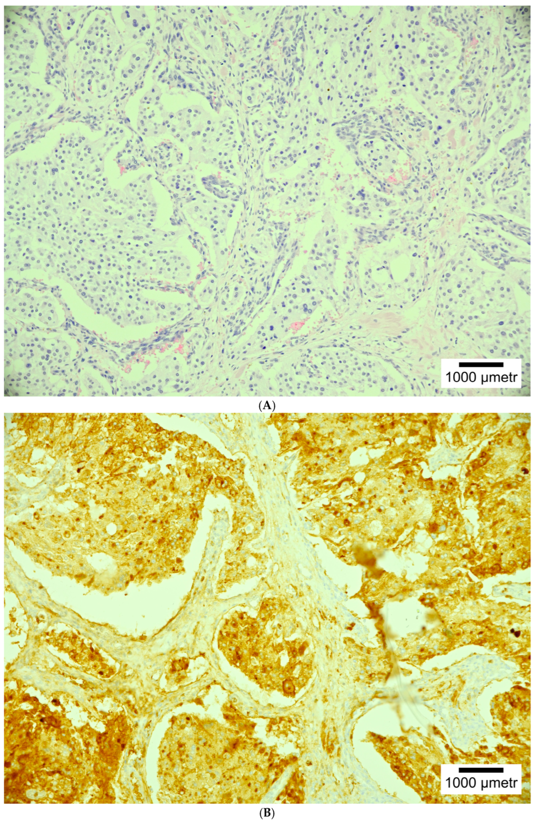 Cancers 17 01029 g002a