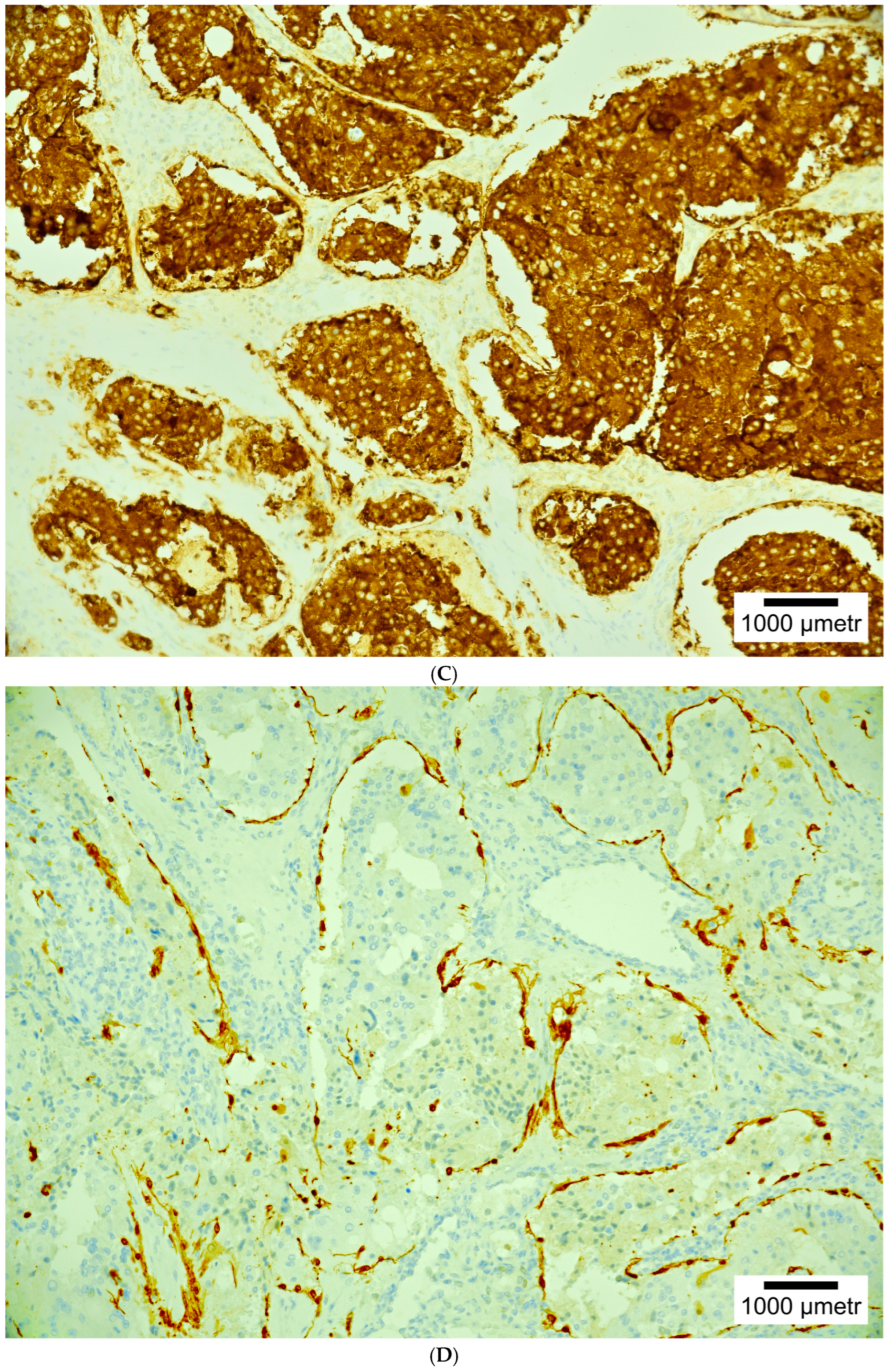 Cancers 17 01029 g002b