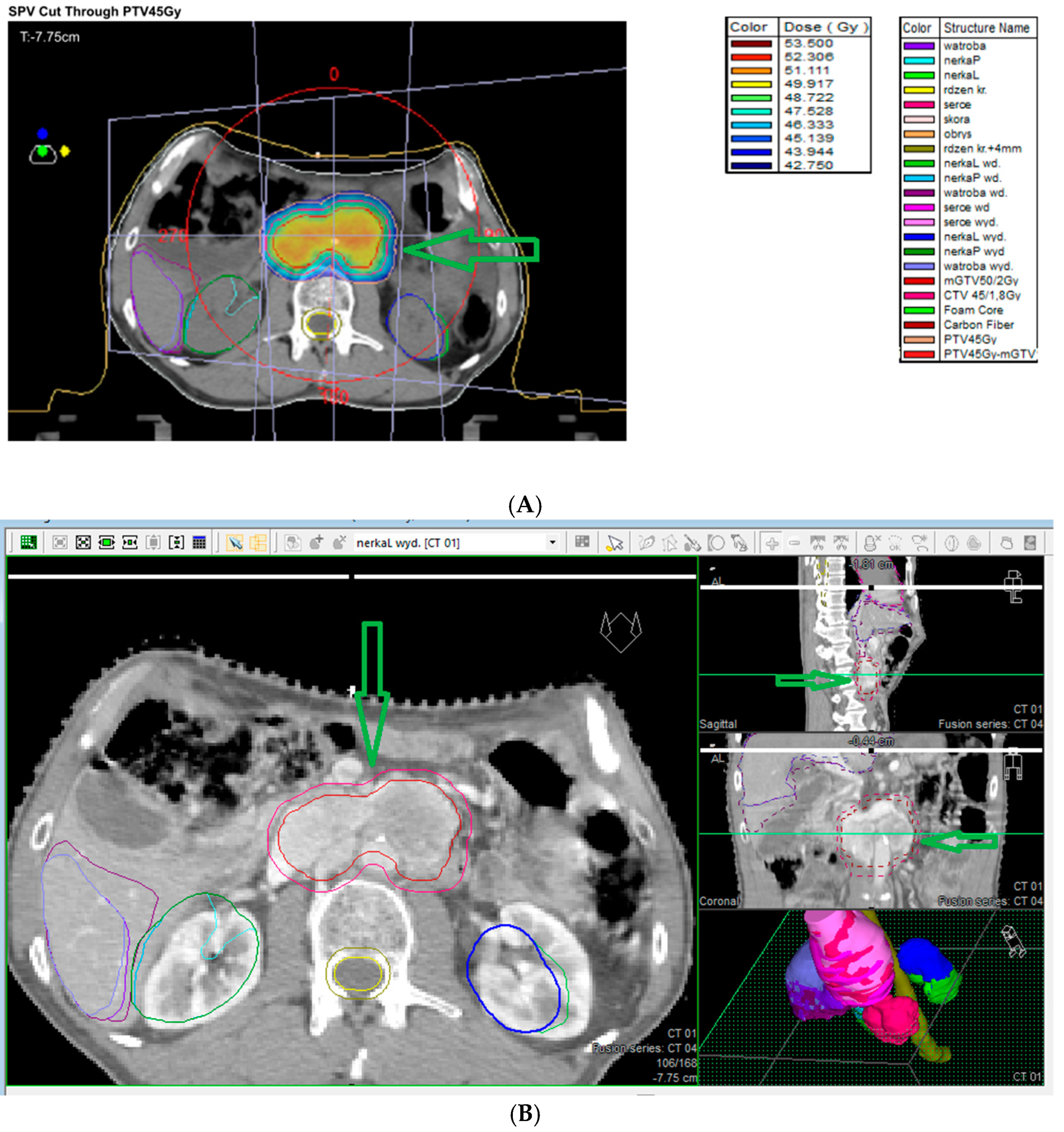 Cancers 17 01029 g006