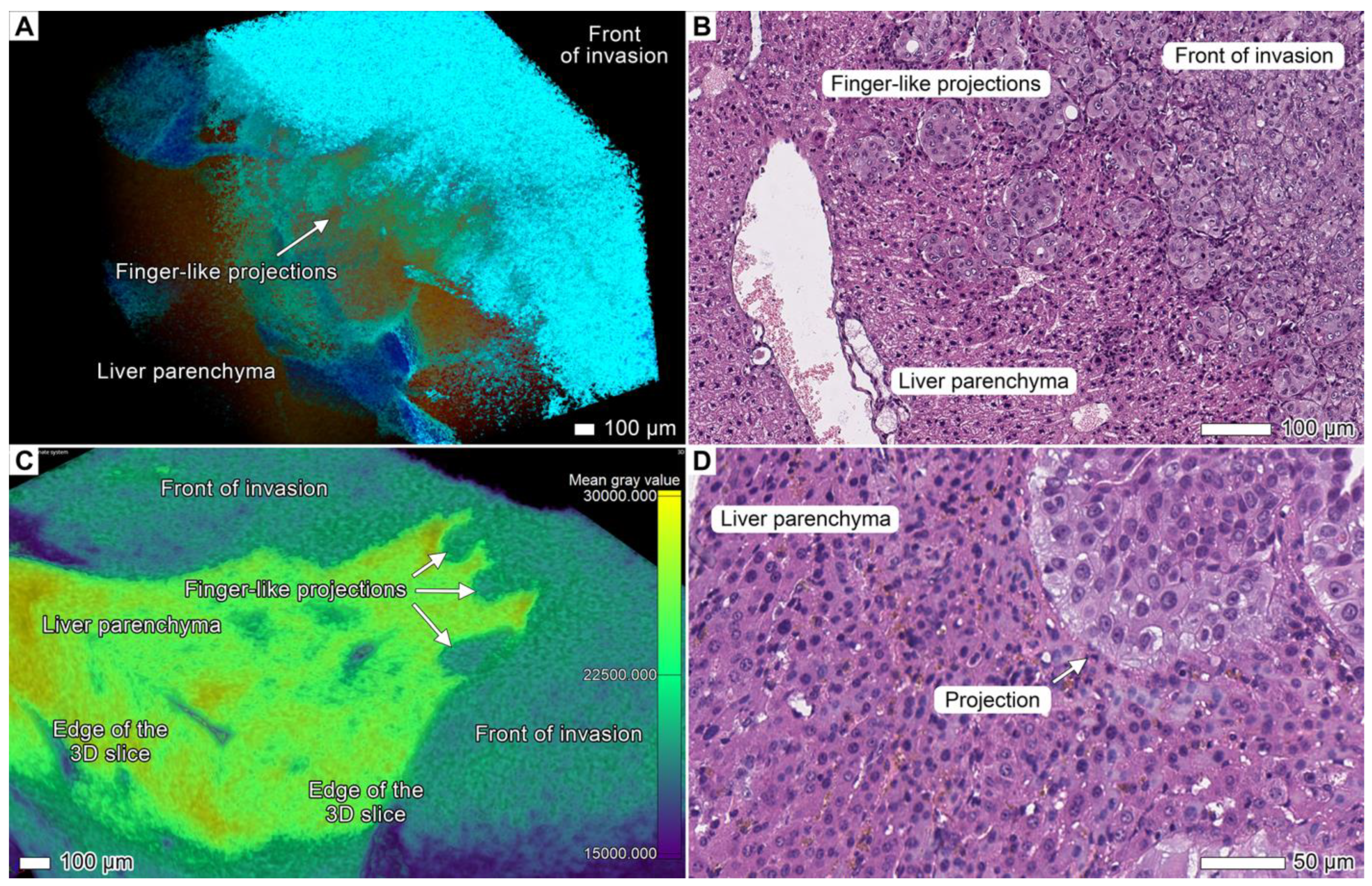 Cancers 17 01139 g006