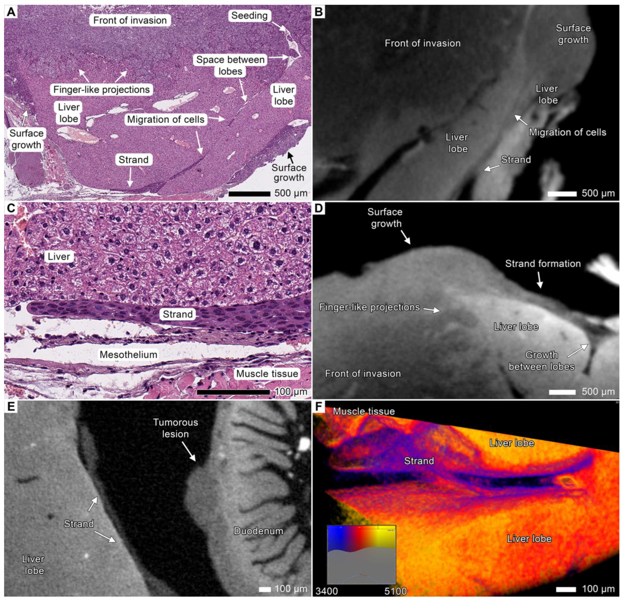 Cancers 17 01139 g007