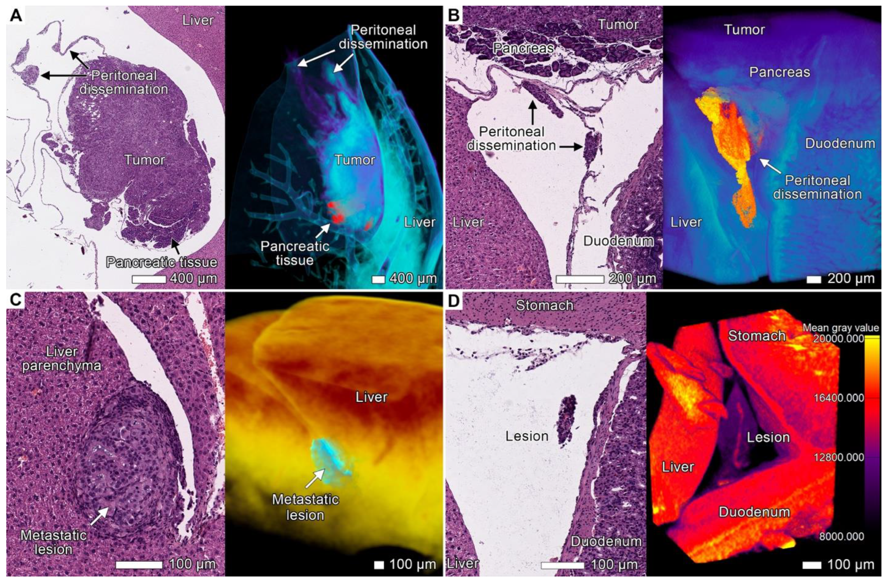 Cancers 17 01139 g008
