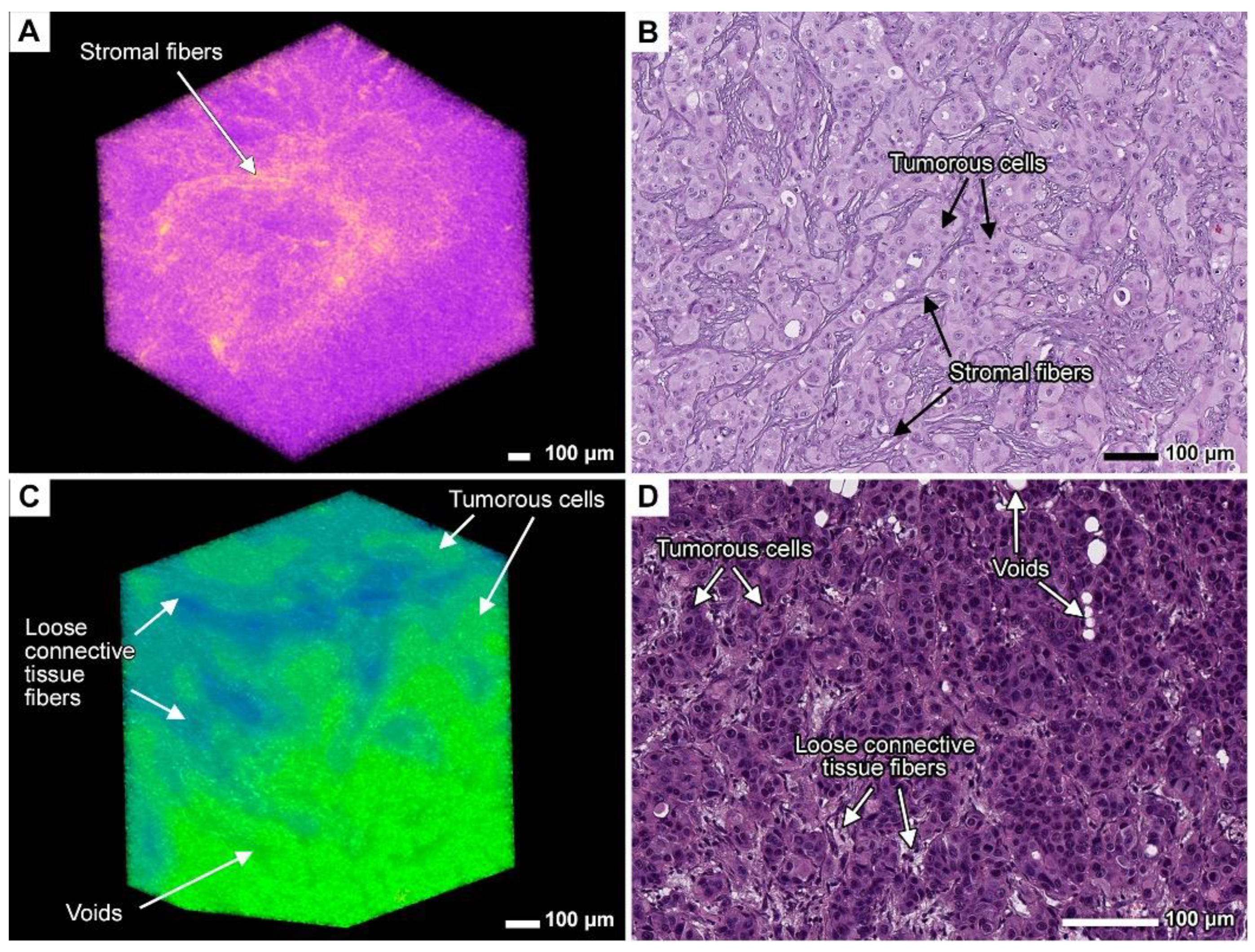 Cancers 17 01139 g010