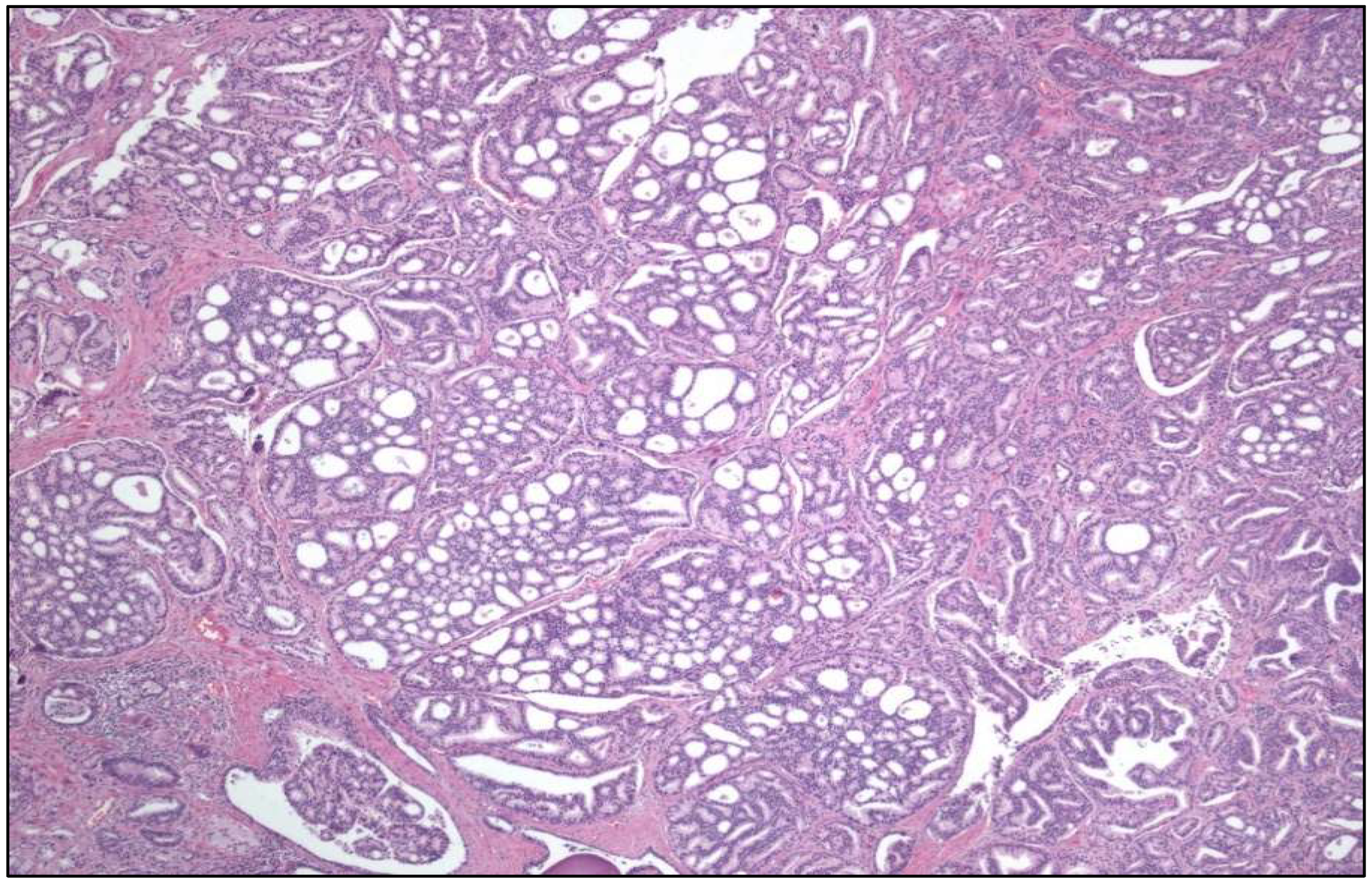 Cancers 17 01173 g001