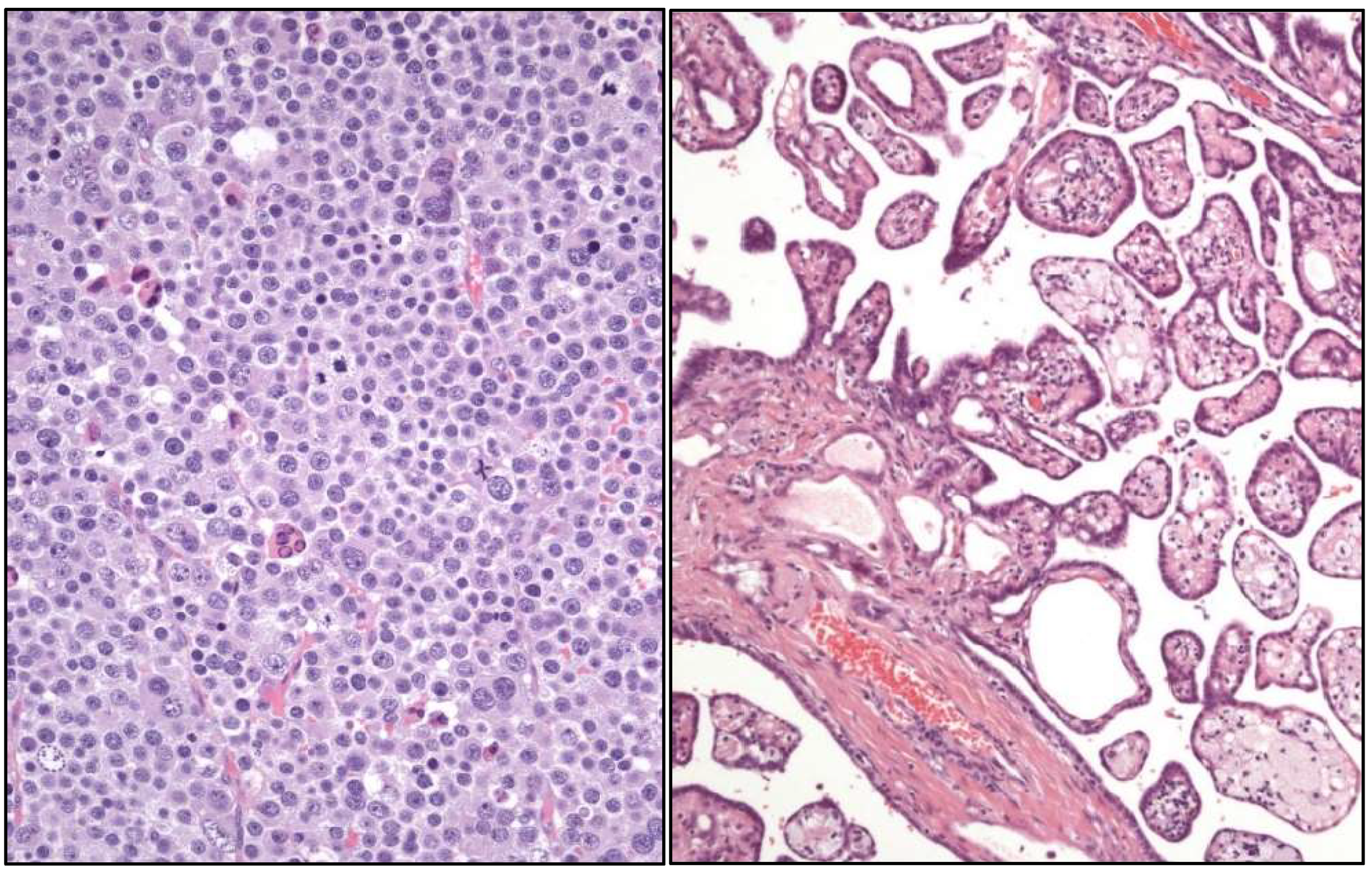 Cancers 17 01173 g004