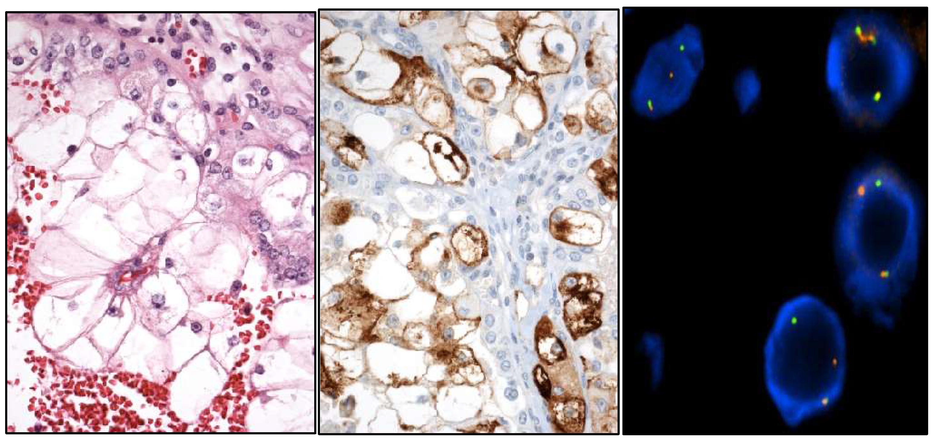 Cancers 17 01173 g007