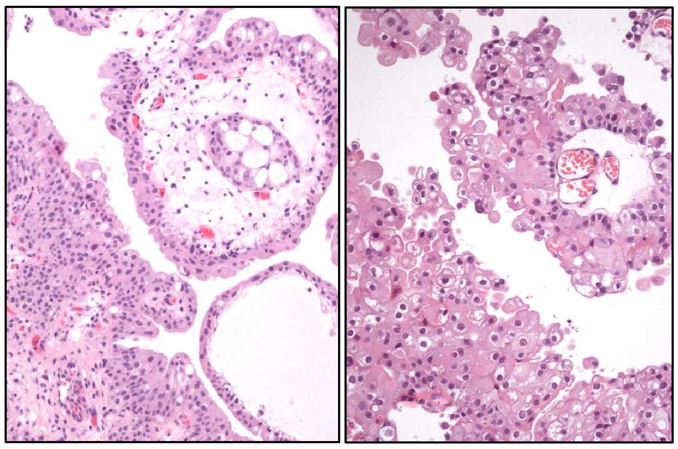 Cancers 17 01173 g010