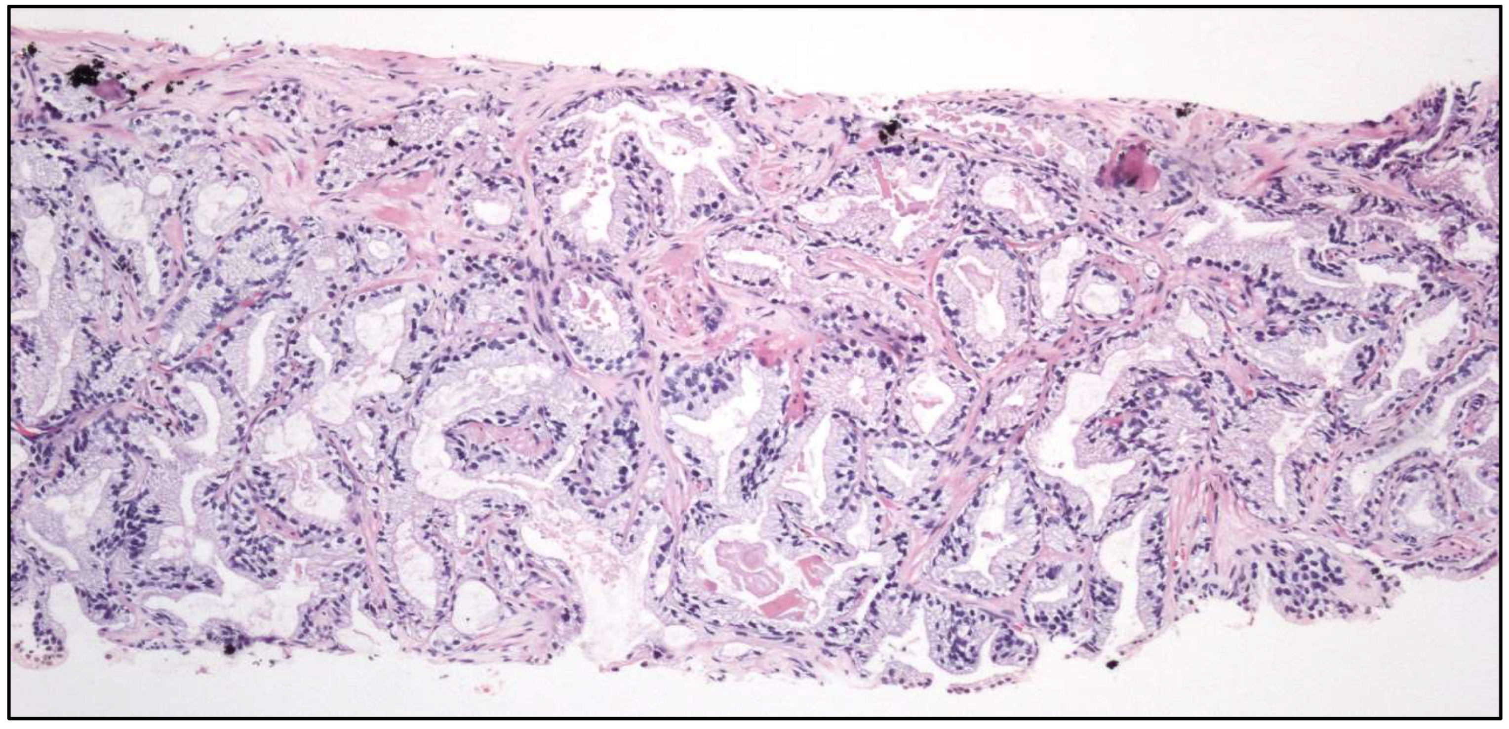 Cancers 17 01173 g011