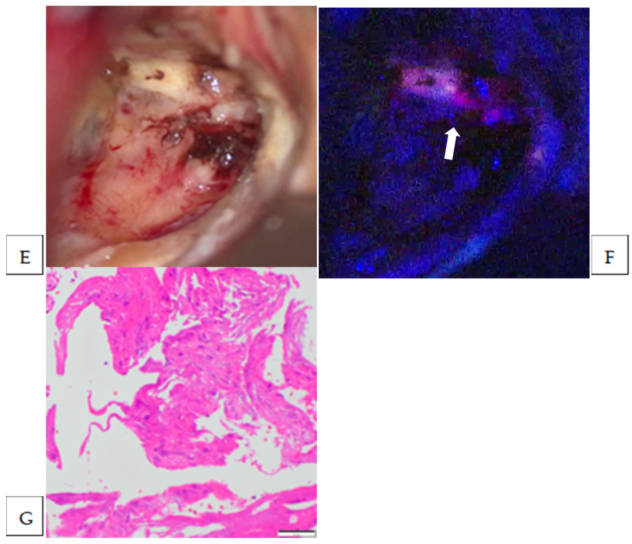 Cancers 17 01191 g001b