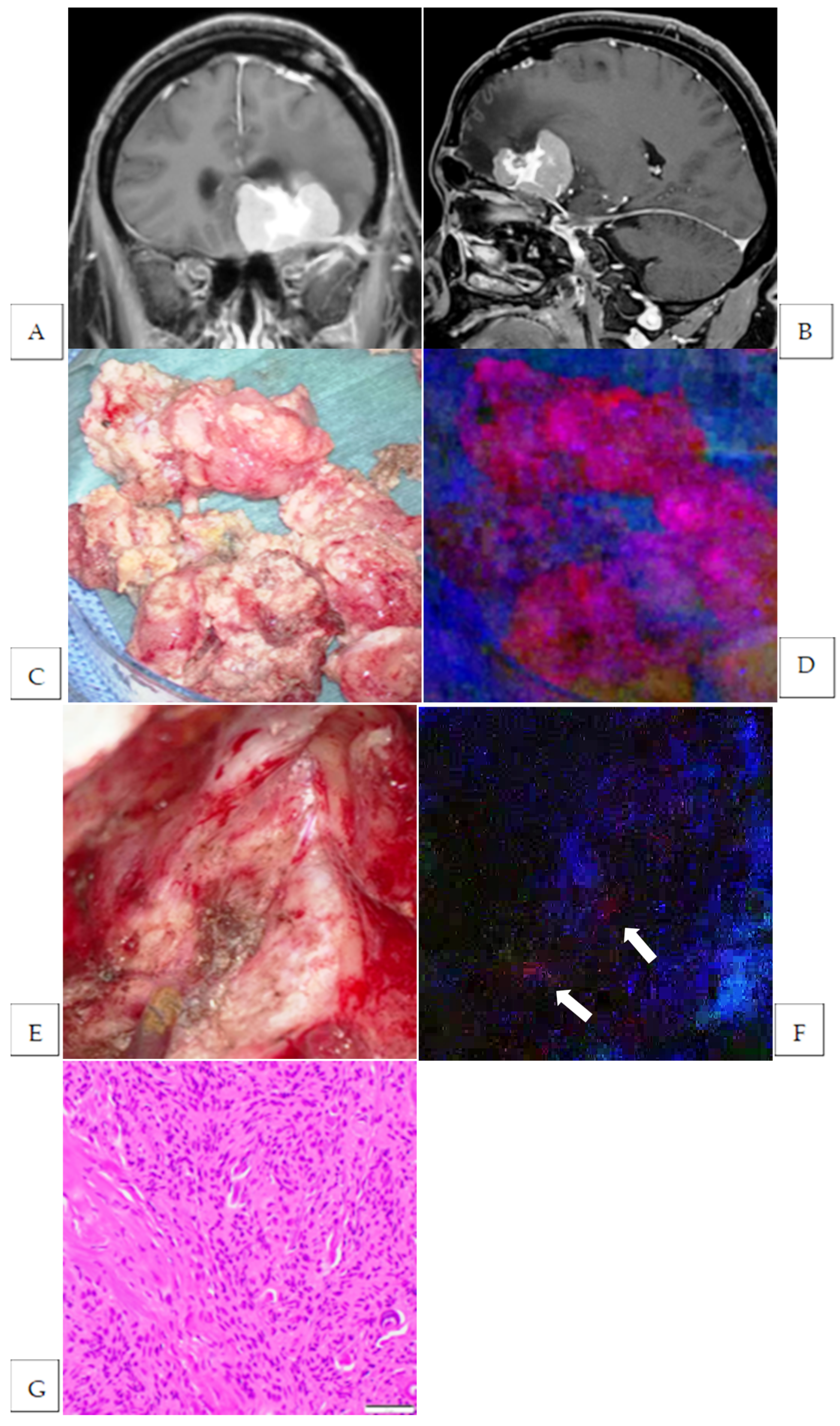 Cancers 17 01191 g003