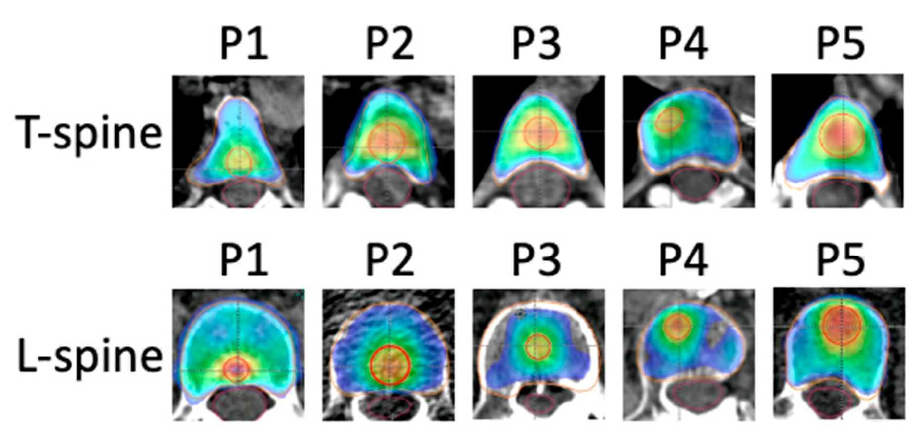 Cancers 17 01216 g002