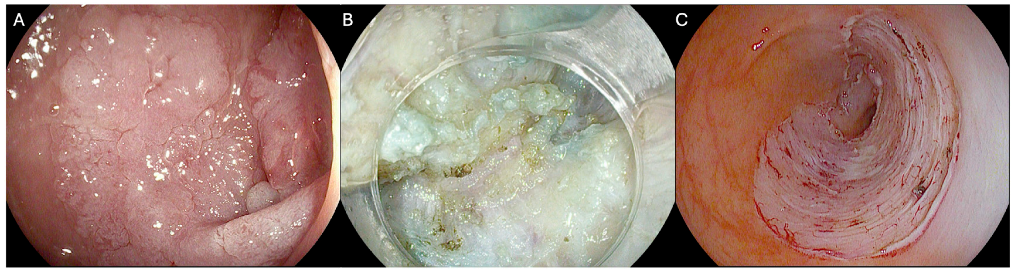 Cancers 17 01242 g001