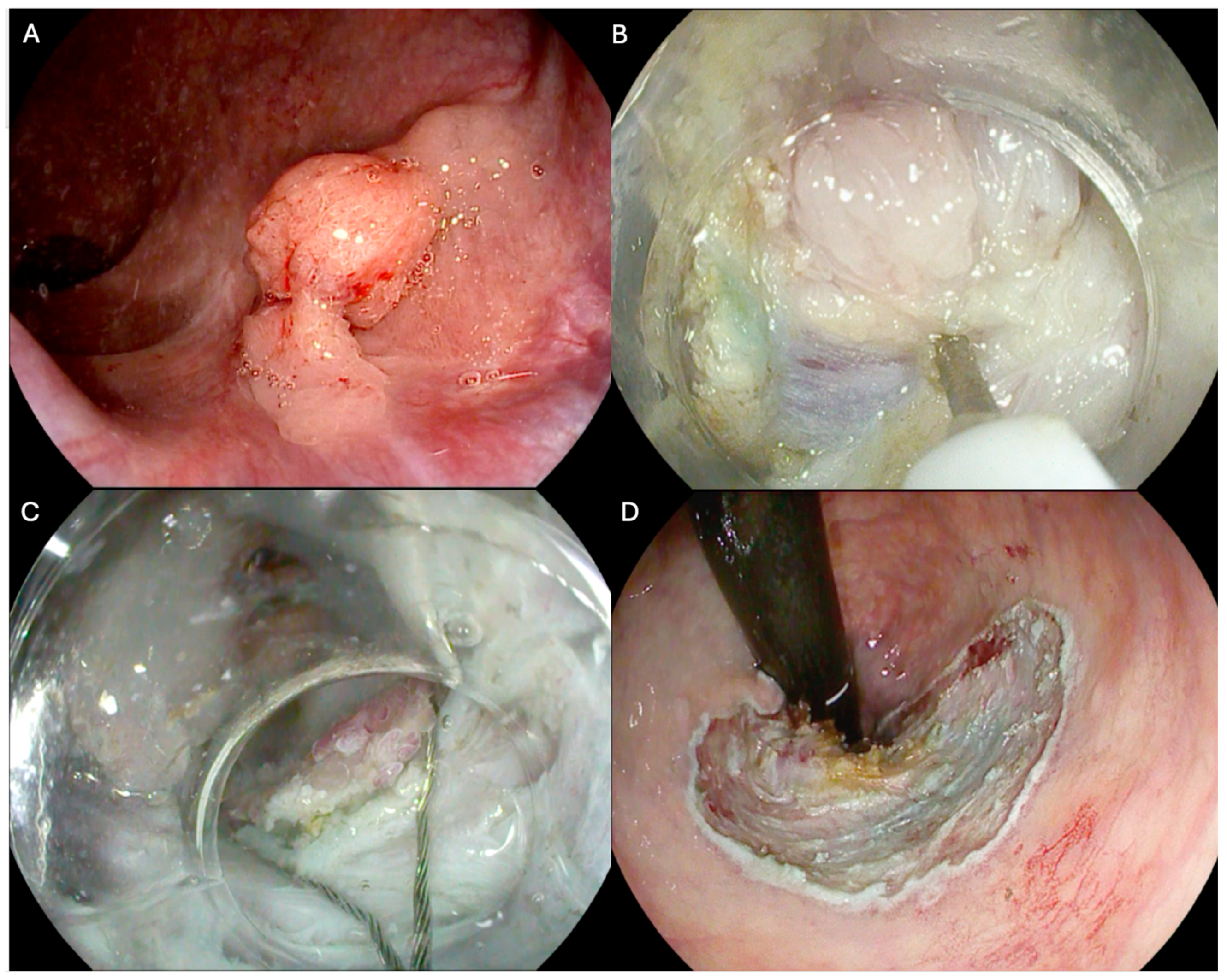 Cancers 17 01242 g002