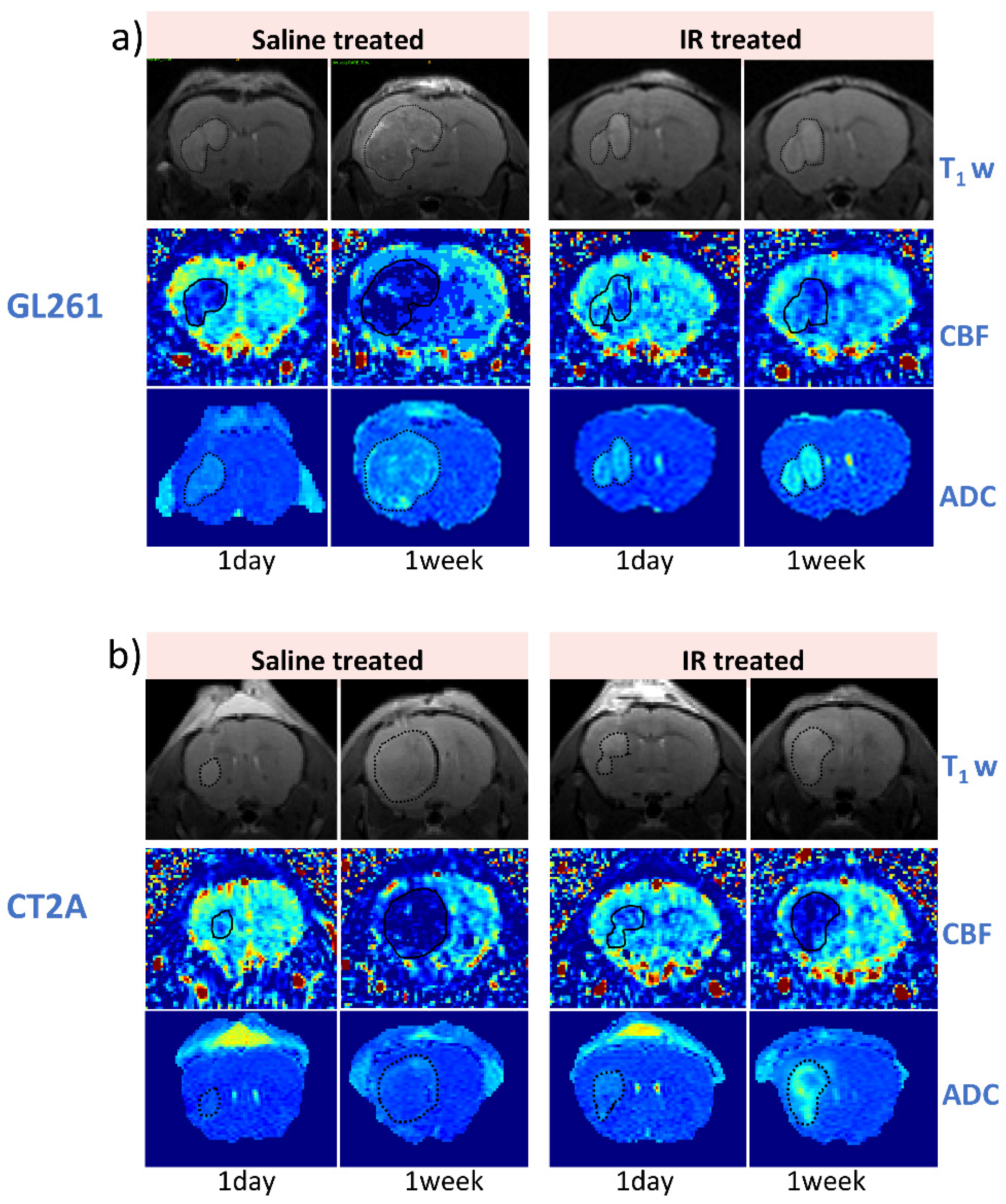 Cancers 17 01258 g003a