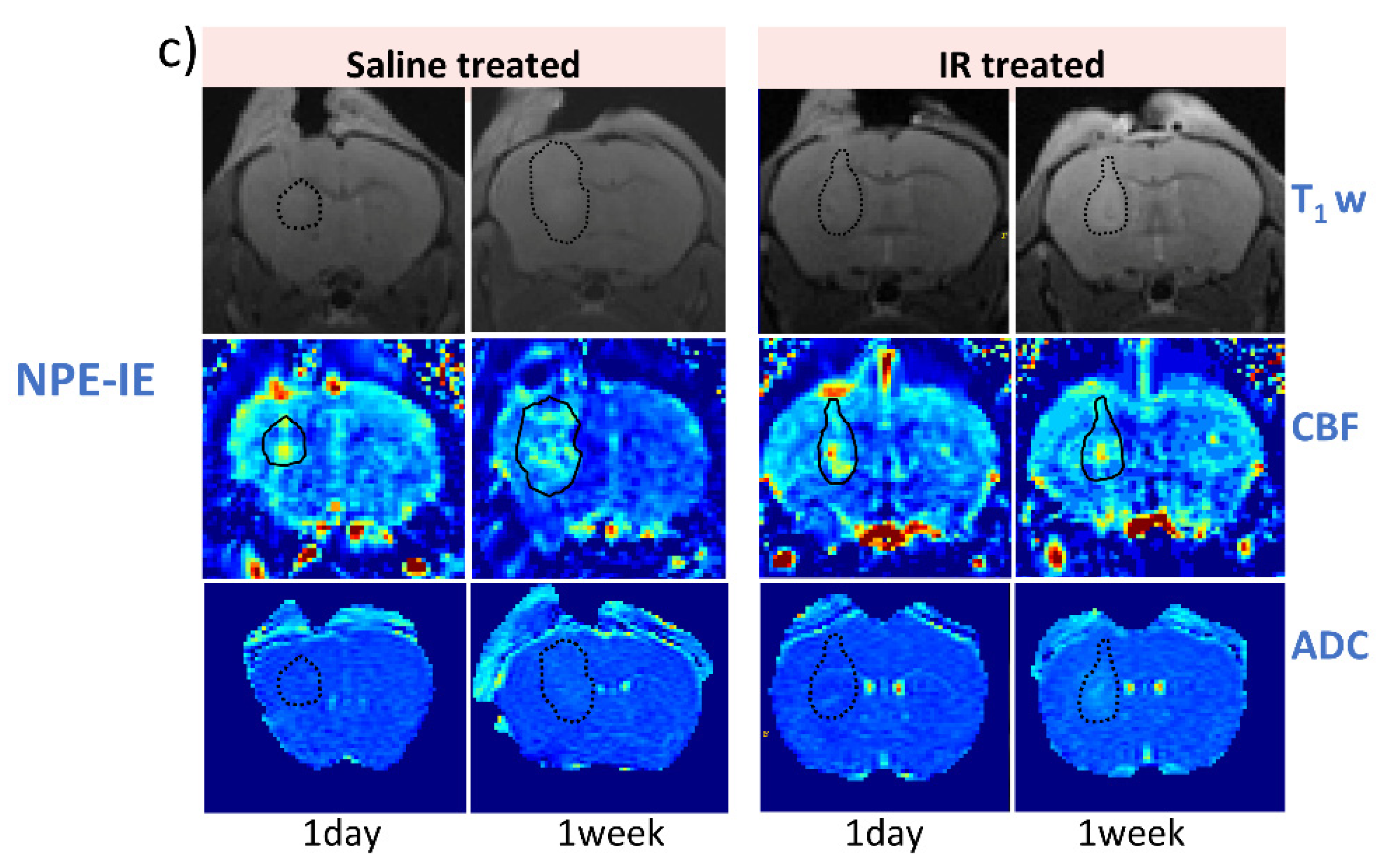 Cancers 17 01258 g003b