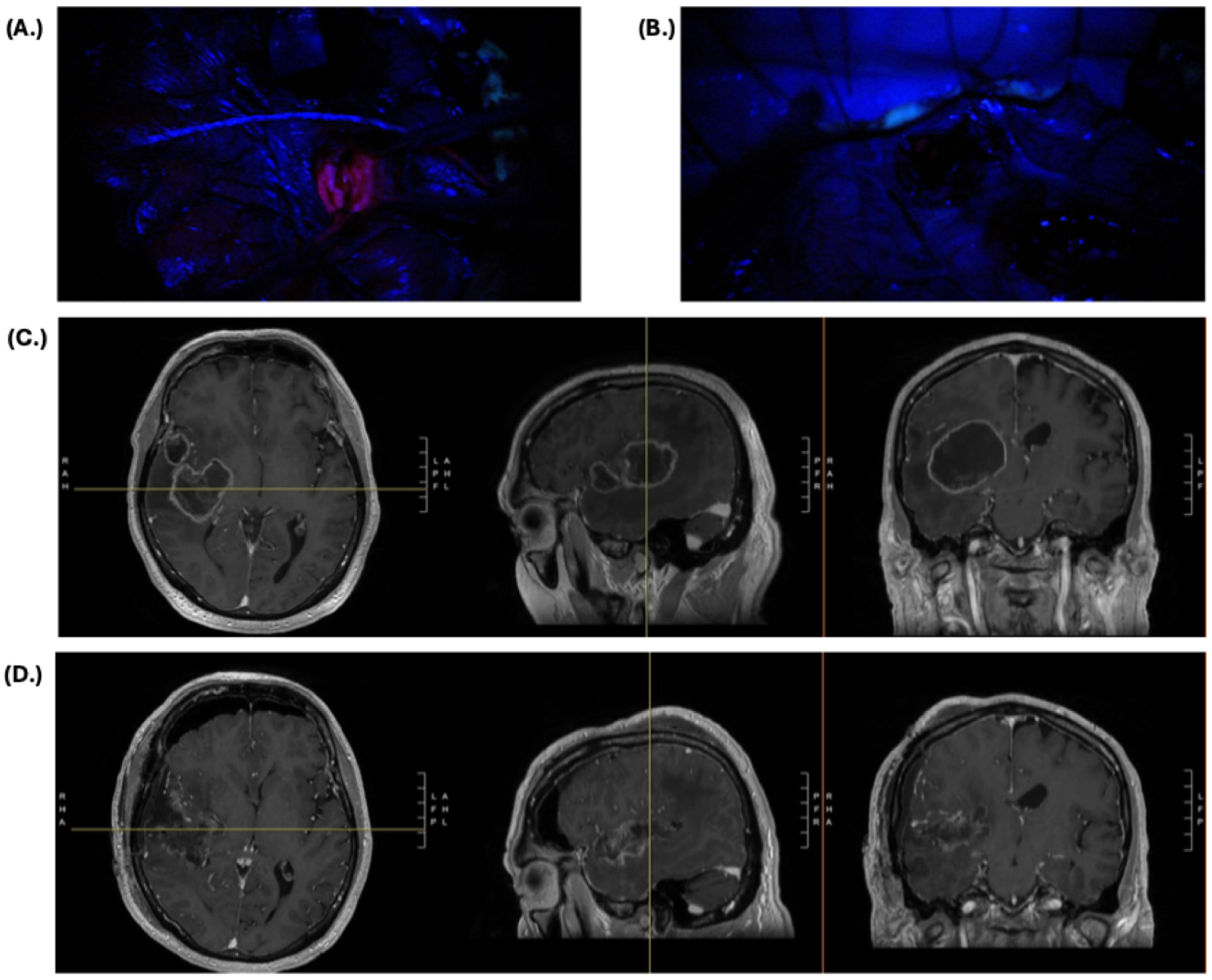 Cancers 17 01332 g001