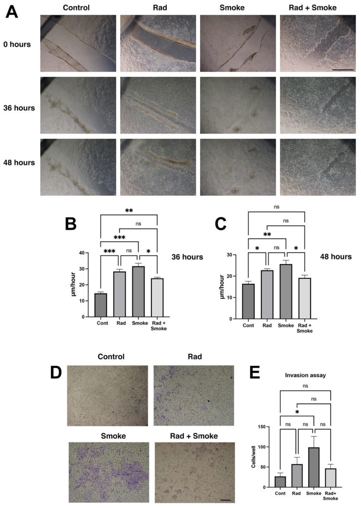 Cancers 17 01346 g002
