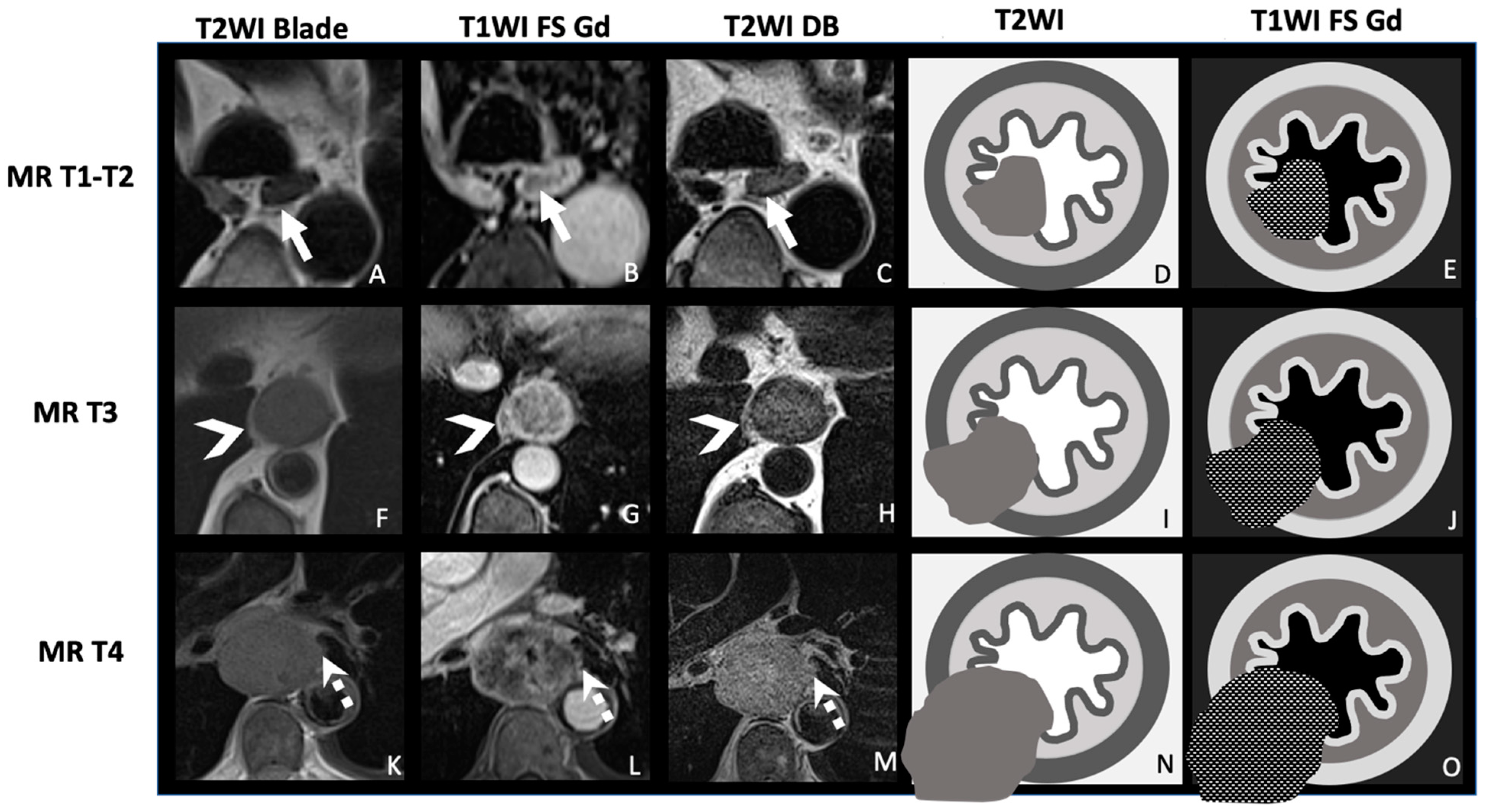 Cancers 17 01351 g002