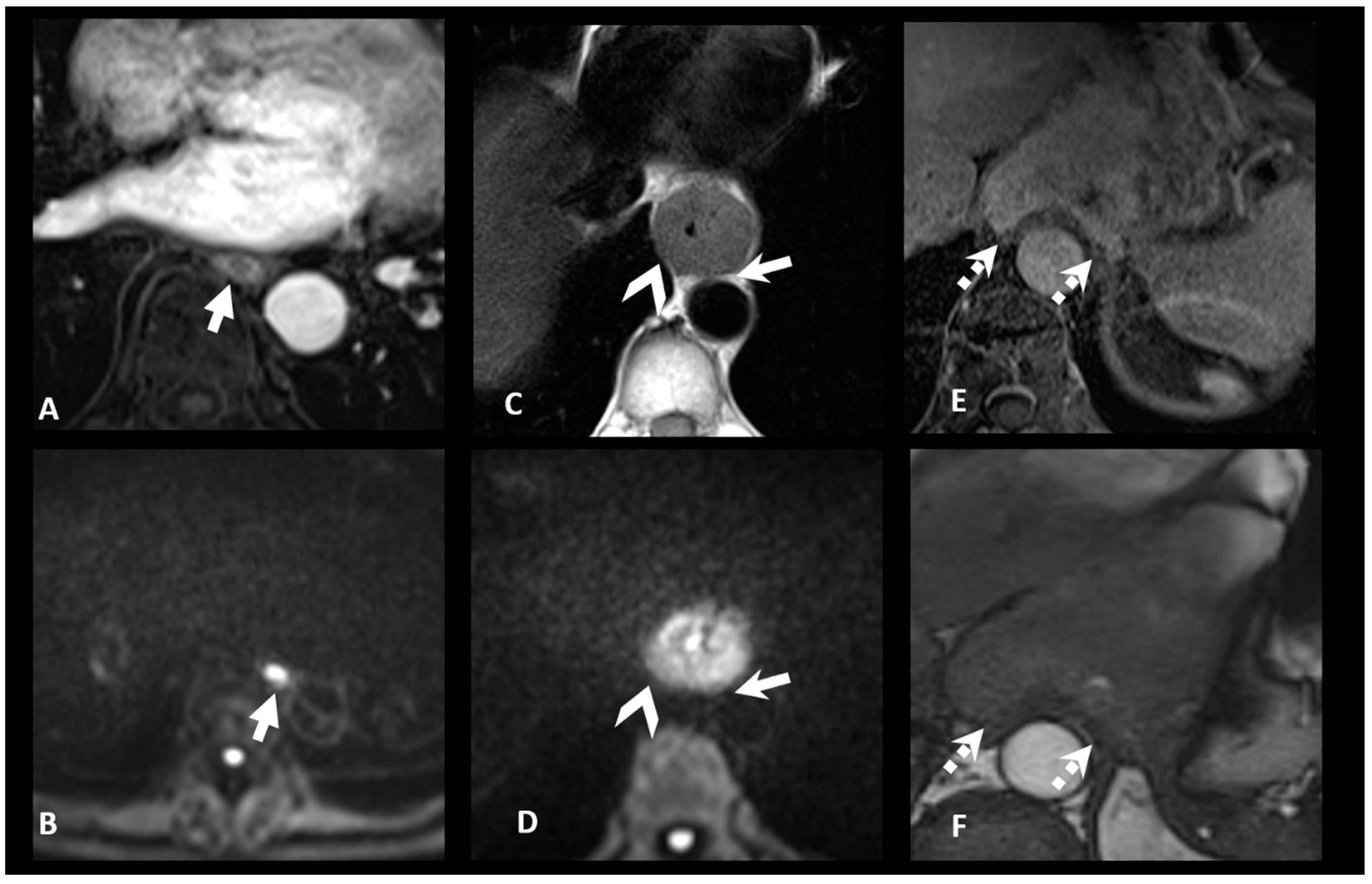 Cancers 17 01351 g003