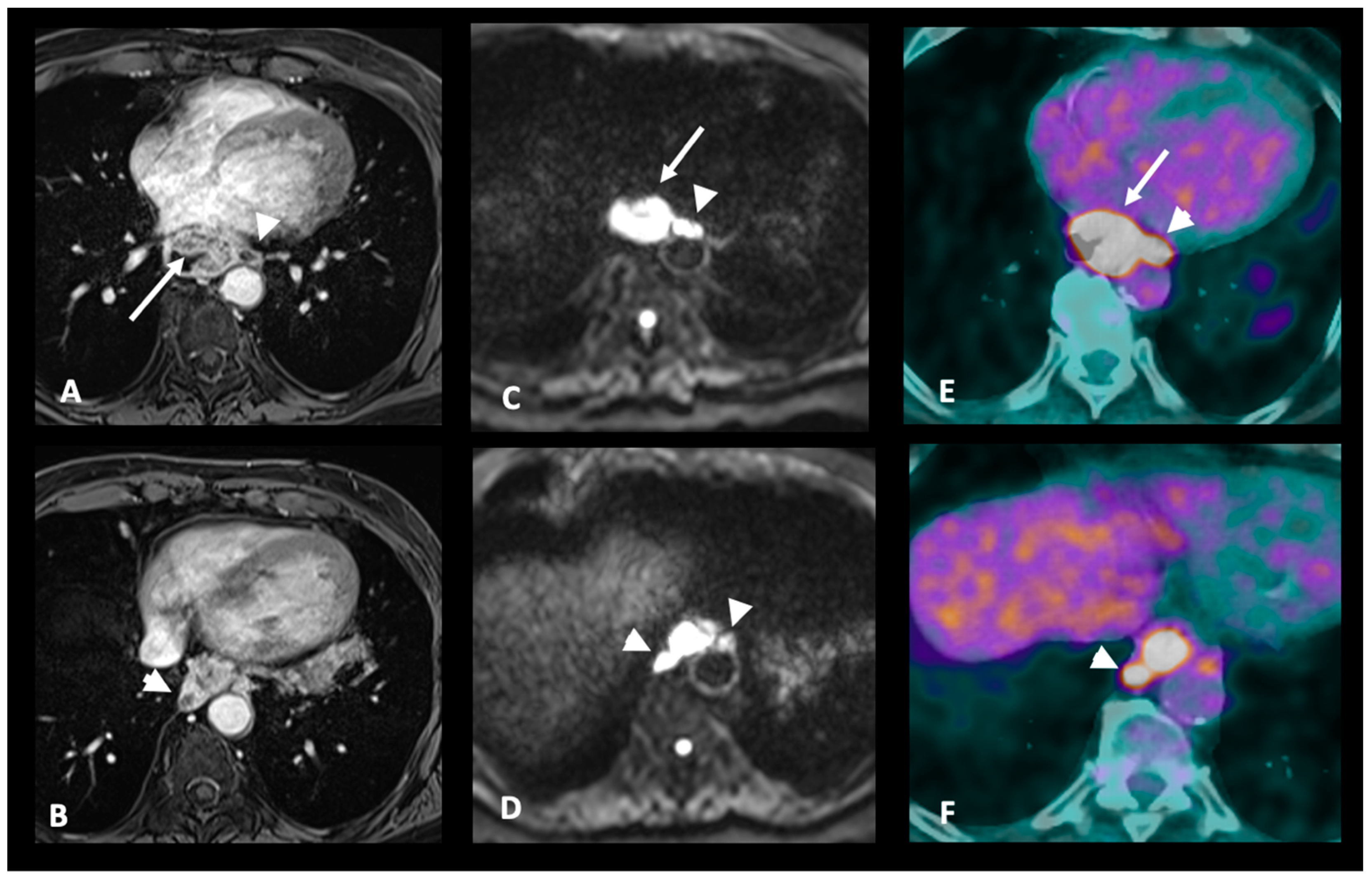 Cancers 17 01351 g005