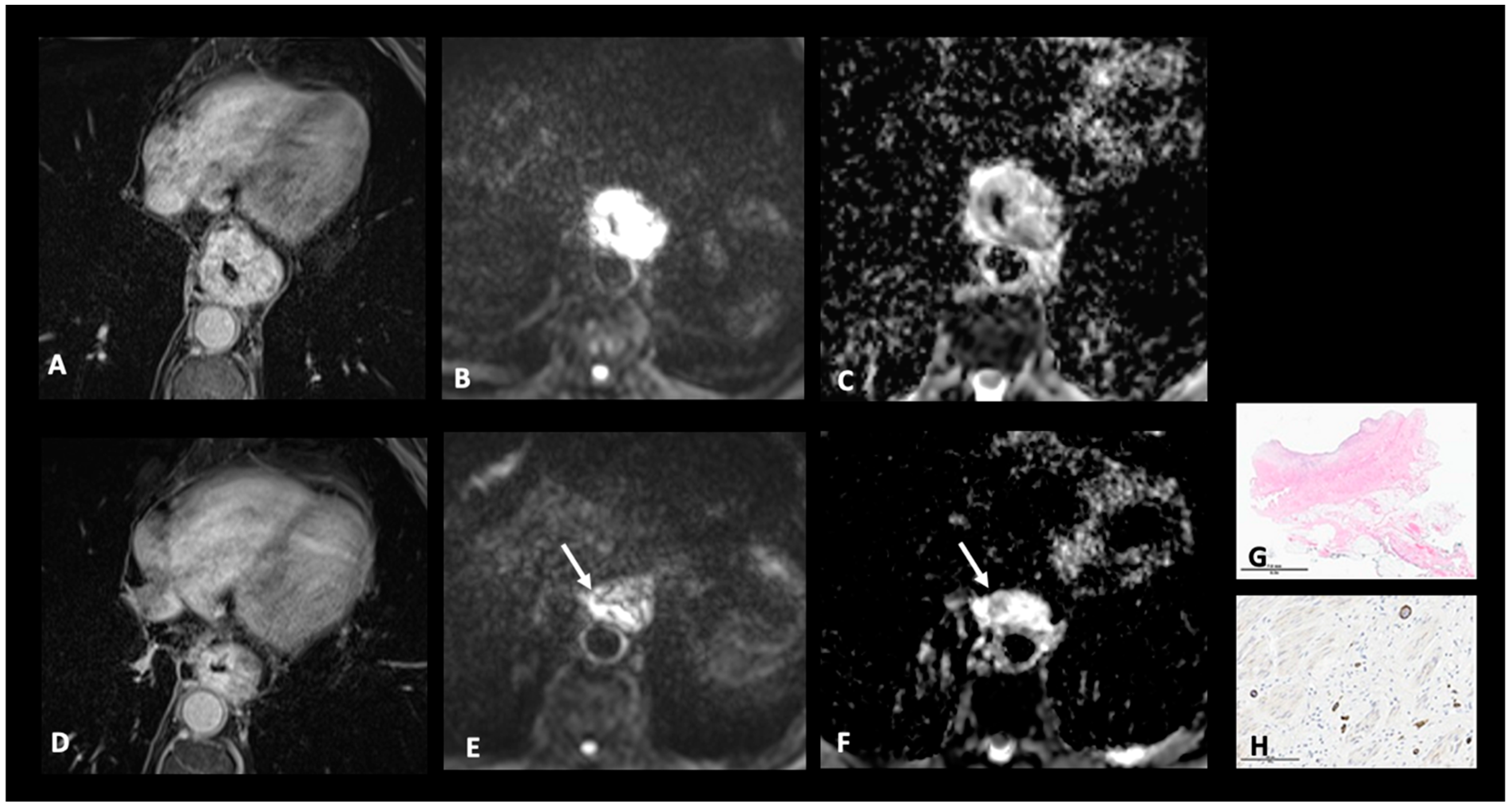 Cancers 17 01351 g006