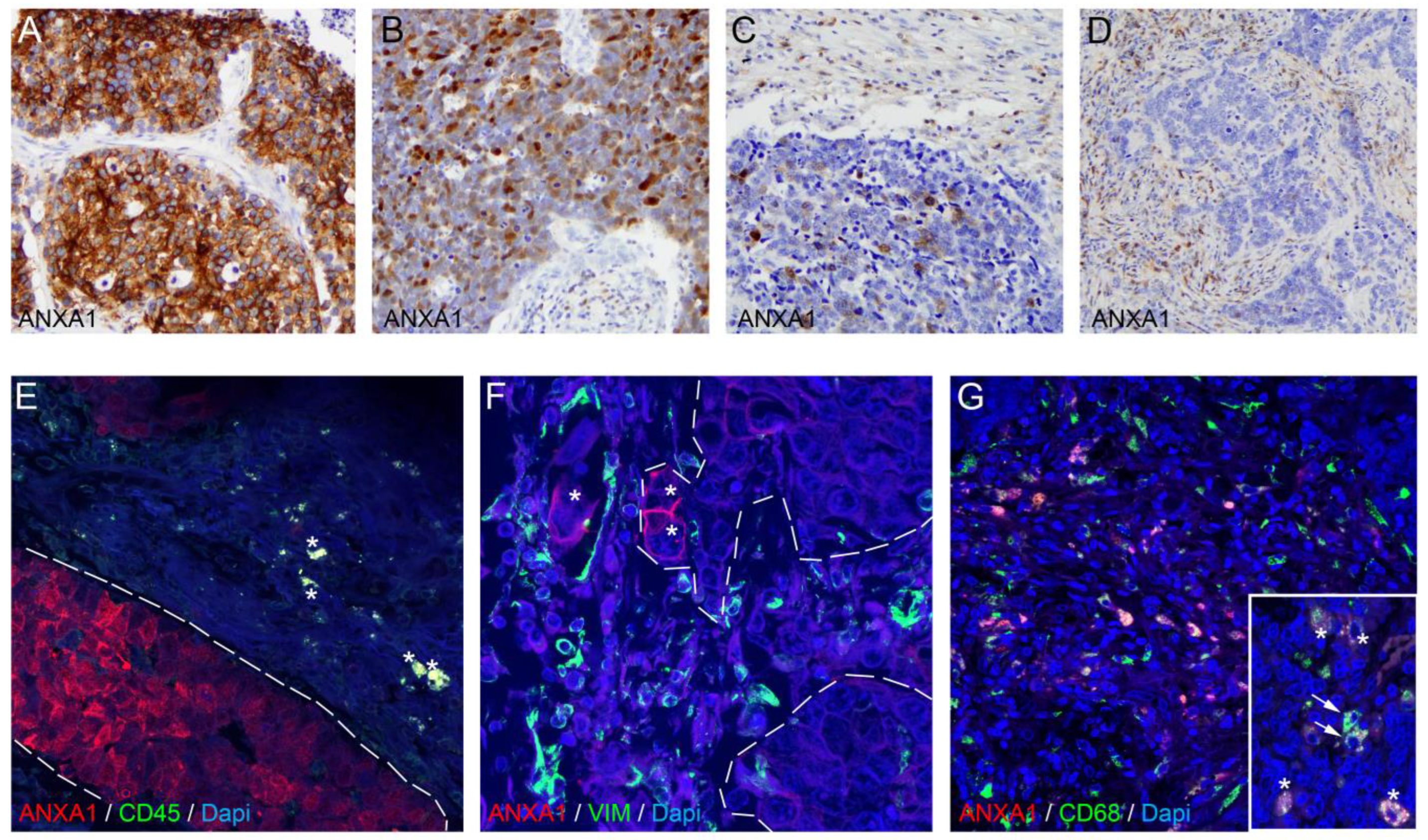 Cancers 17 01407 g004