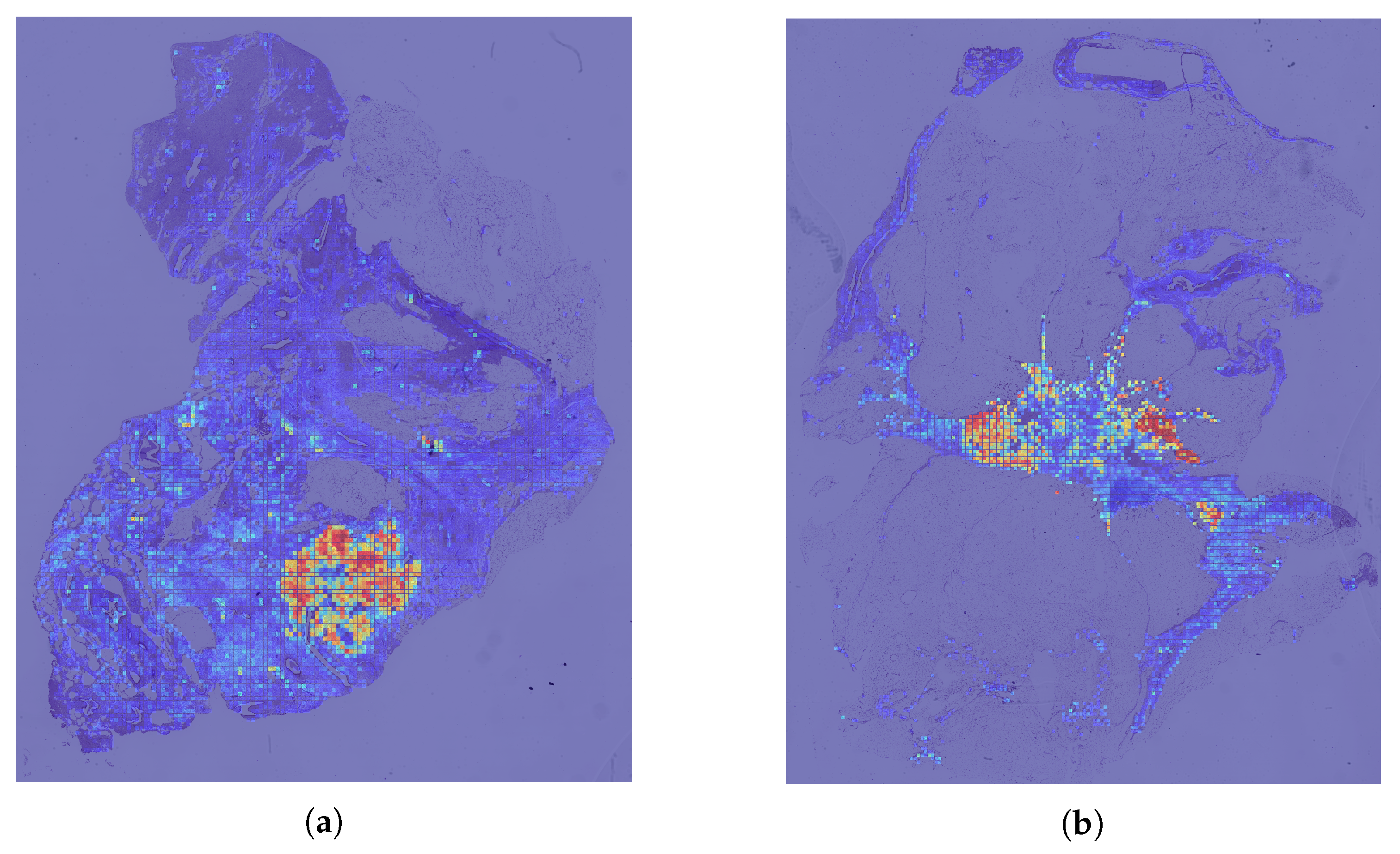 Cancers 17 01425 g003