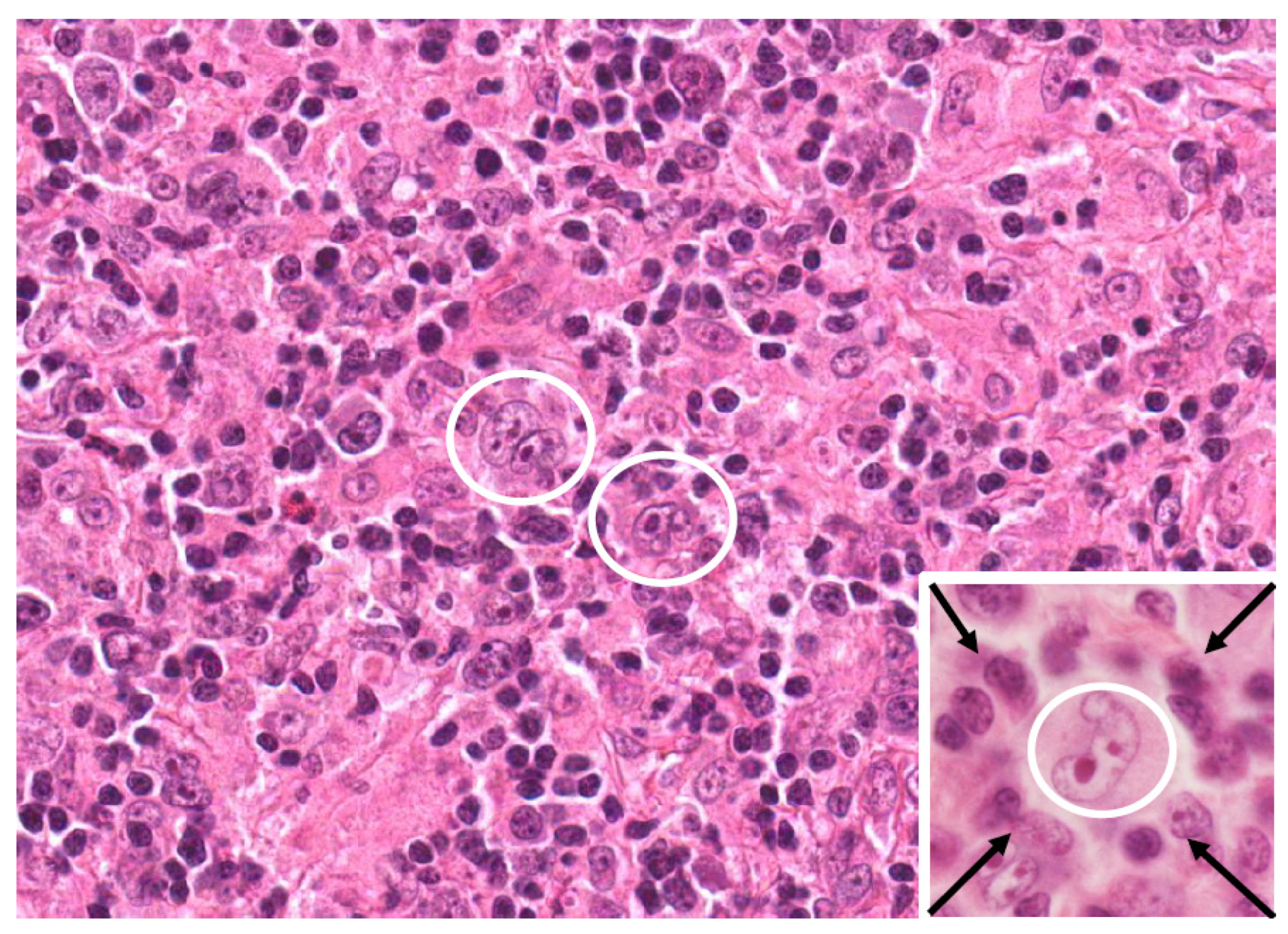 Cancers 17 01433 g001