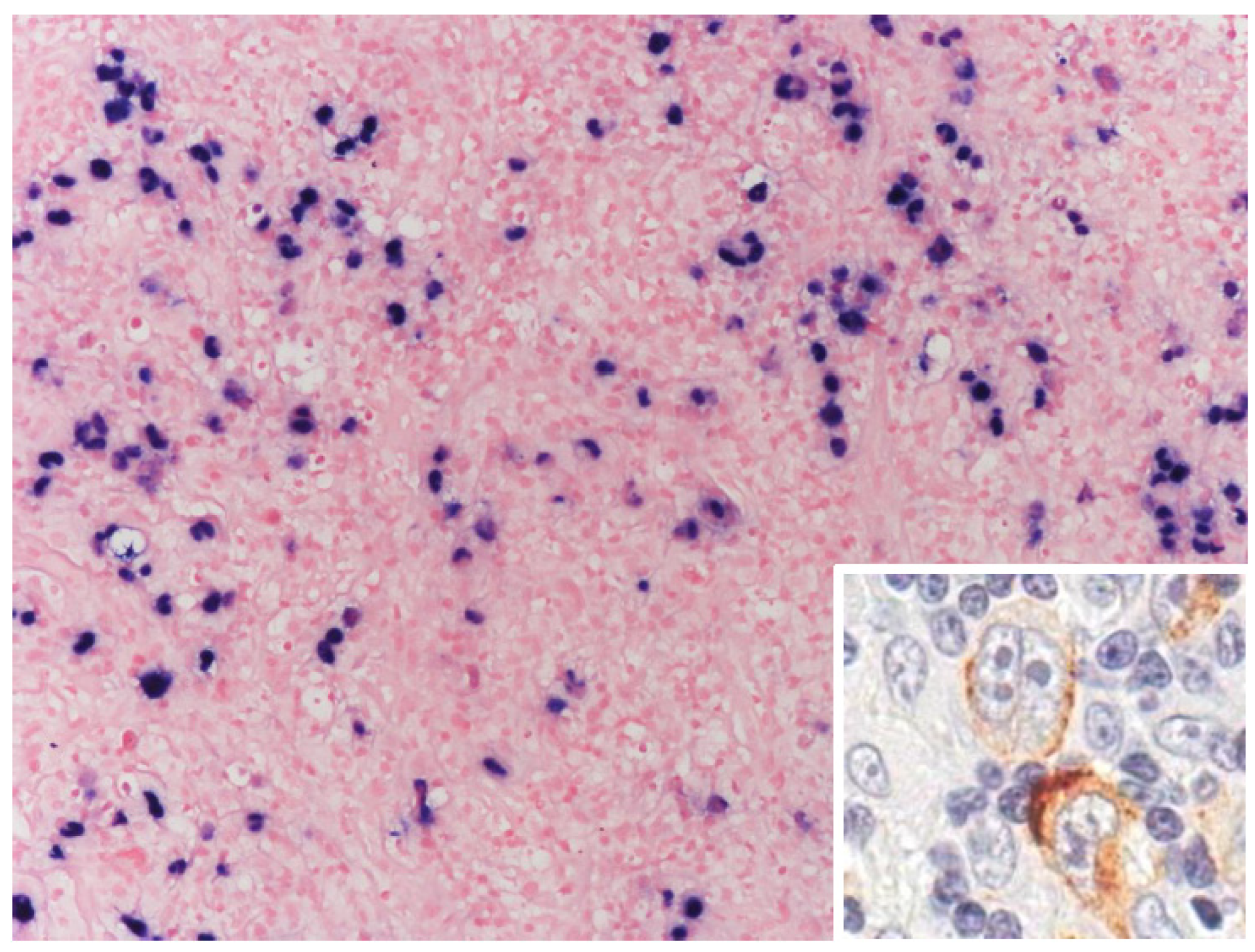 Cancers 17 01433 g002