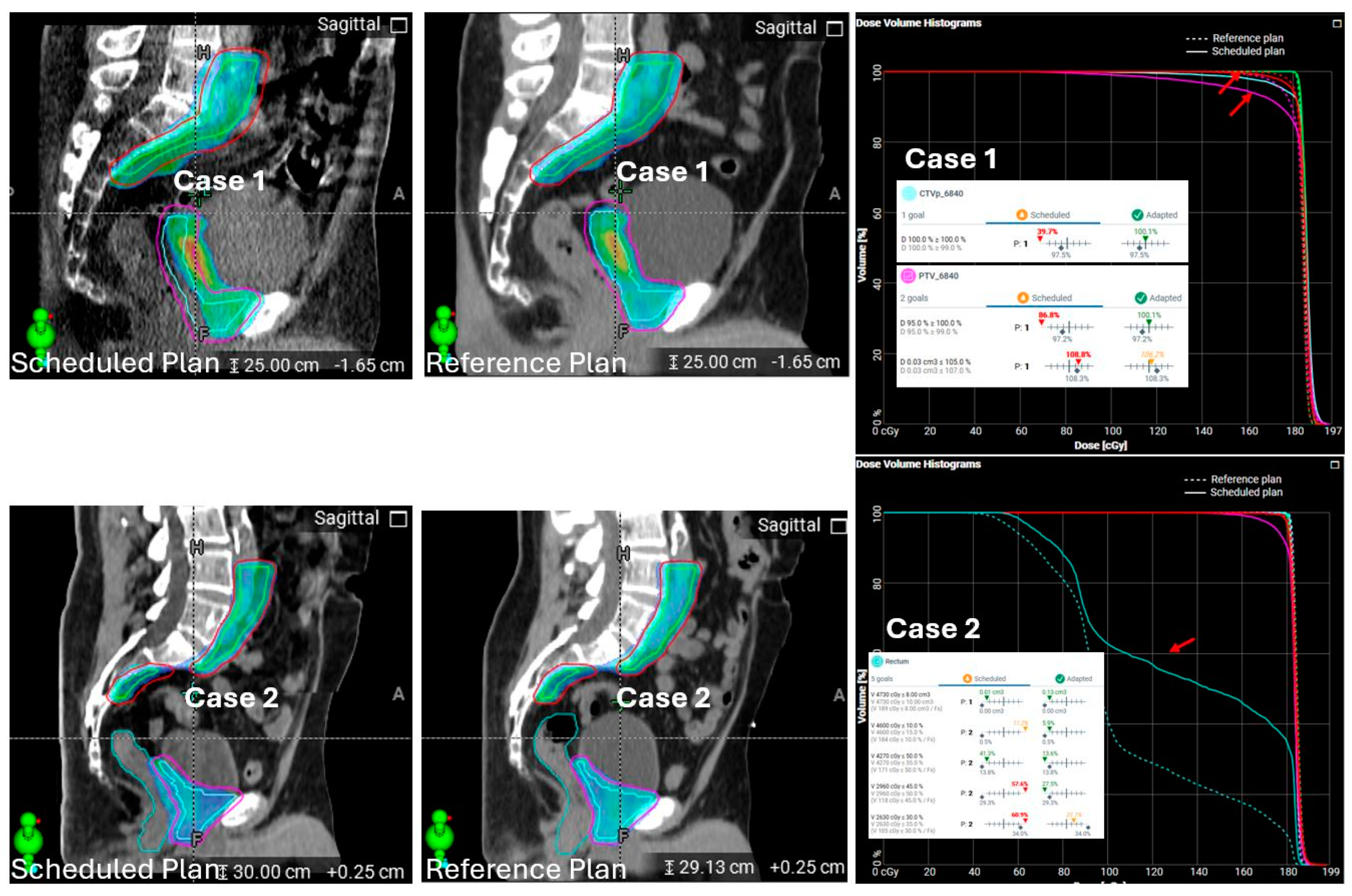Cancers 17 01462 g007